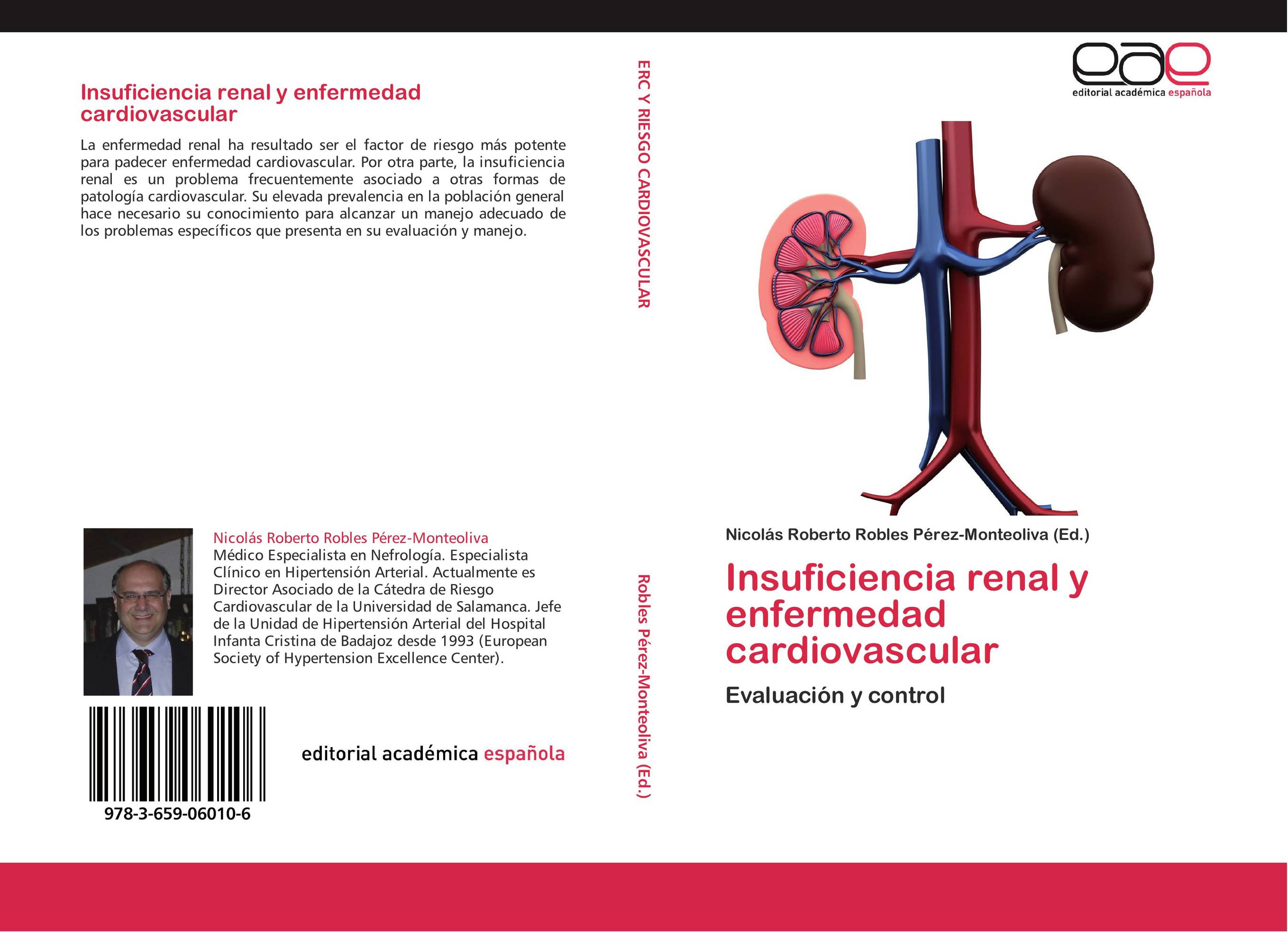 Insuficiencia renal y enfermedad cardiovascular