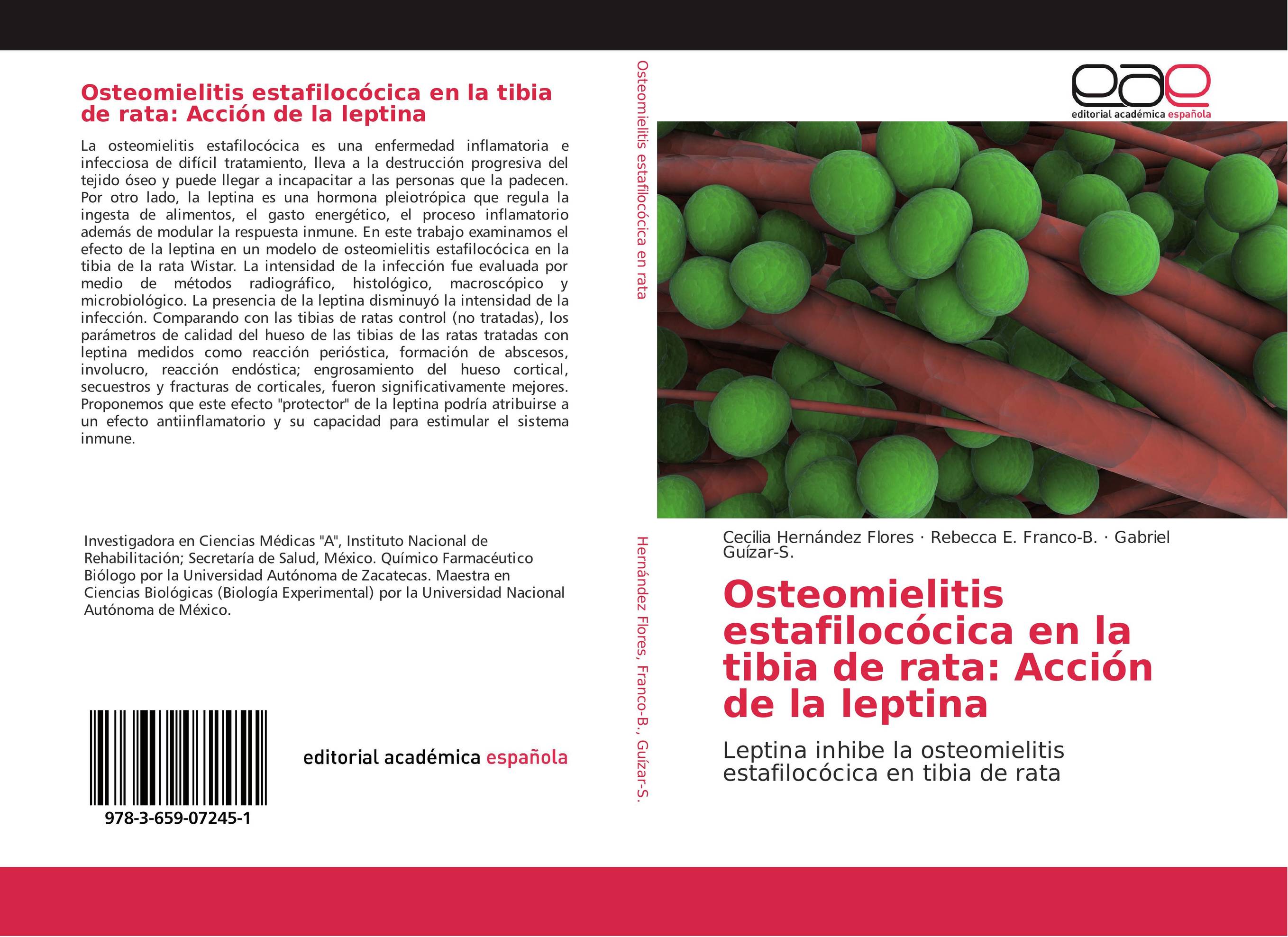 Osteomielitis estafilocócica en la tibia de rata: Acción de la leptina