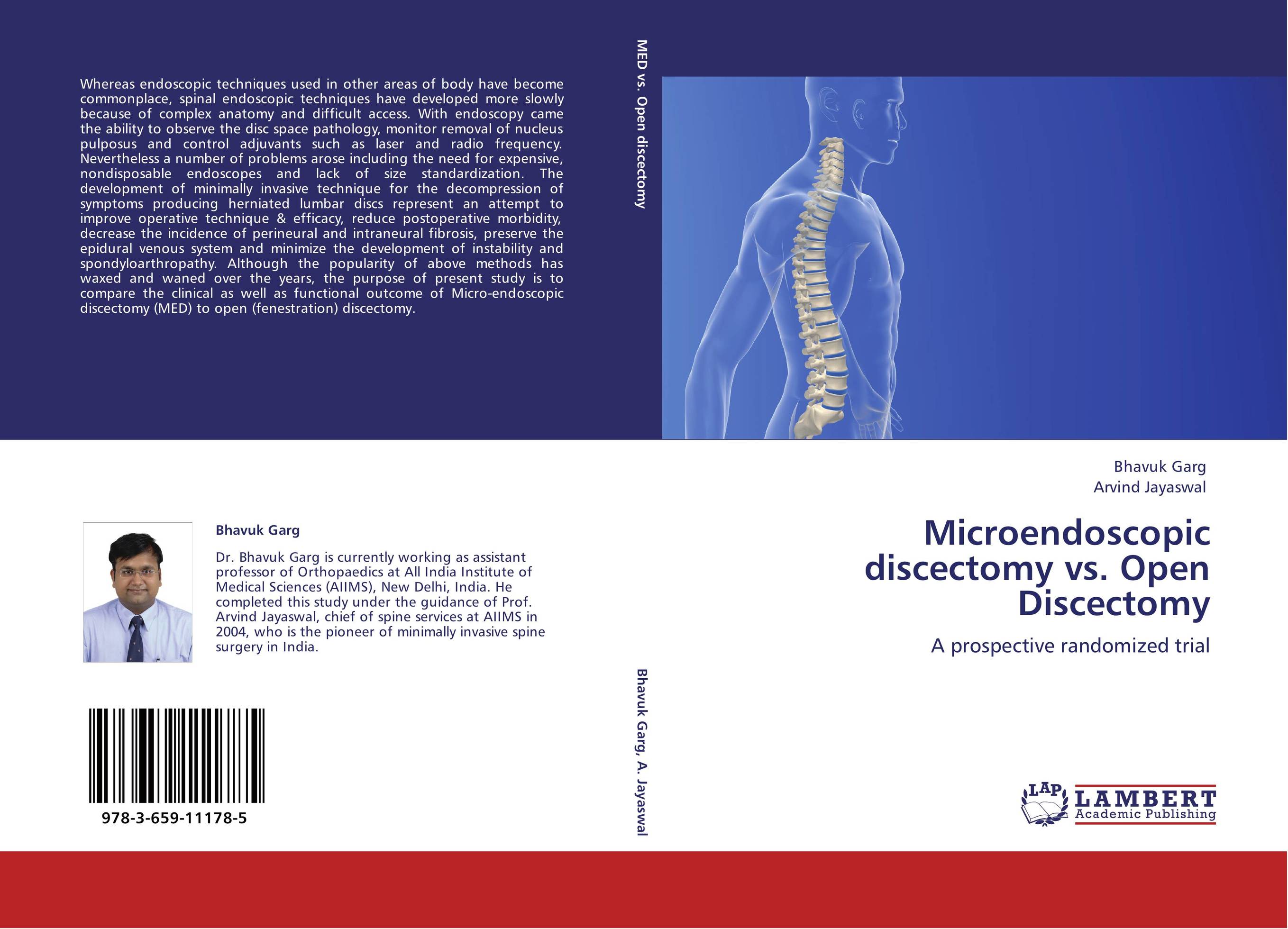 Microendoscopic discectomy vs. Open Discectomy. A prospective randomized trial.