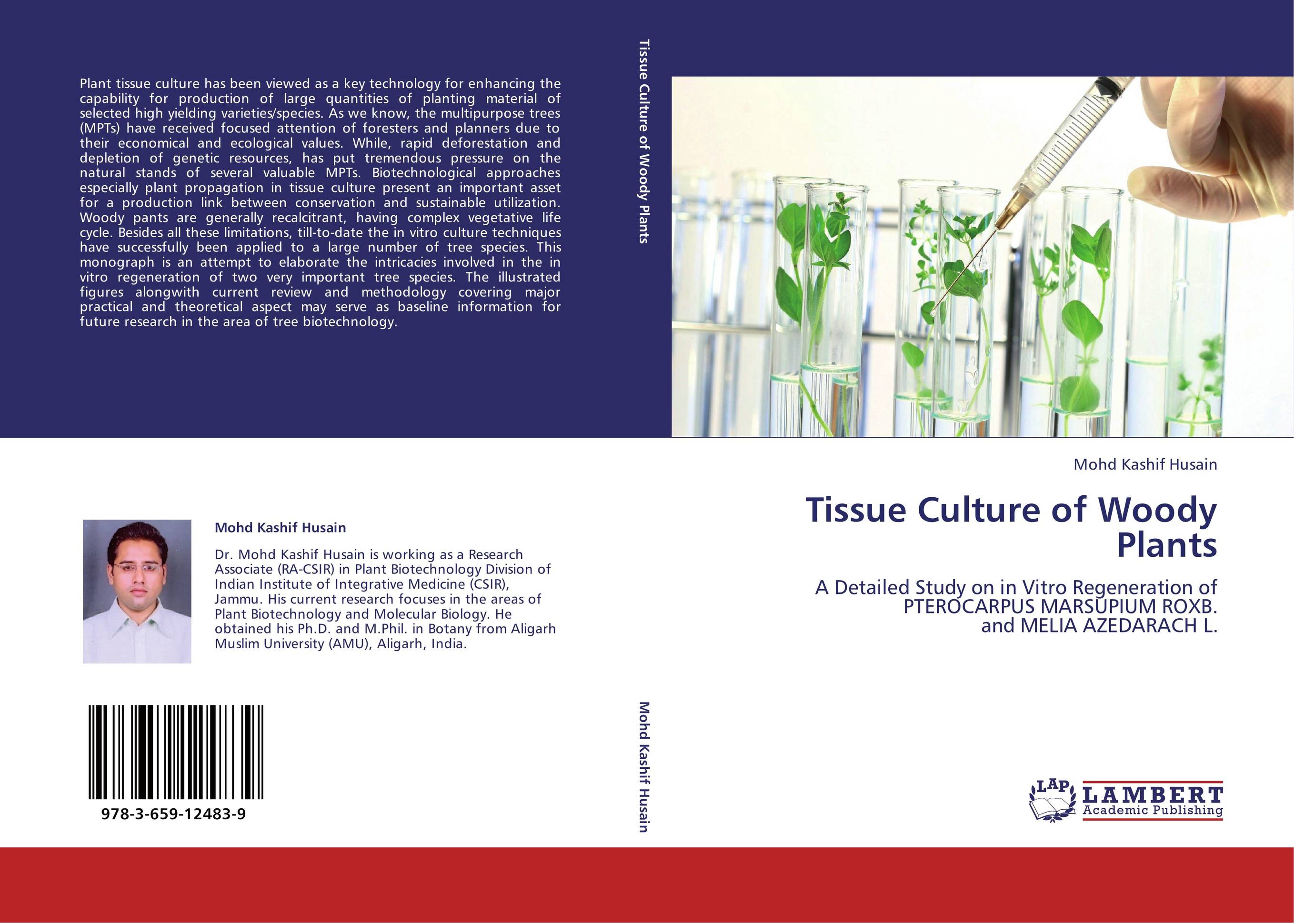 9783659124839 Tissue Culture of Woody Plants Mohd Kashif Husain 9783659124839 Tissue Culture of Woody Plants Mohd Kashif Husain