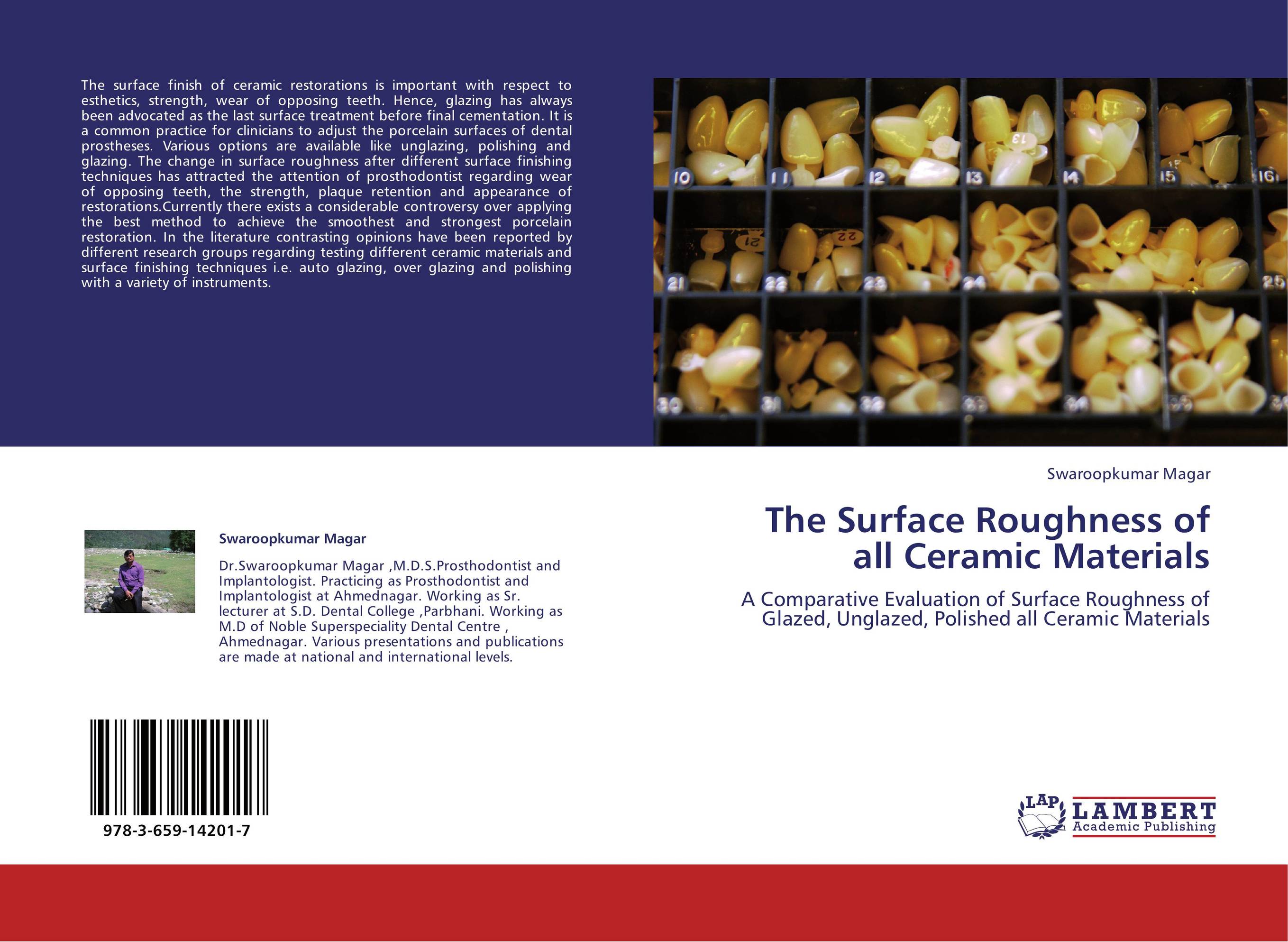 The Surface Roughness of all Ceramic Materials. A Comparative Evaluation of Surface Roughness of Glazed, Unglazed, Polished all Ceramic Materials.