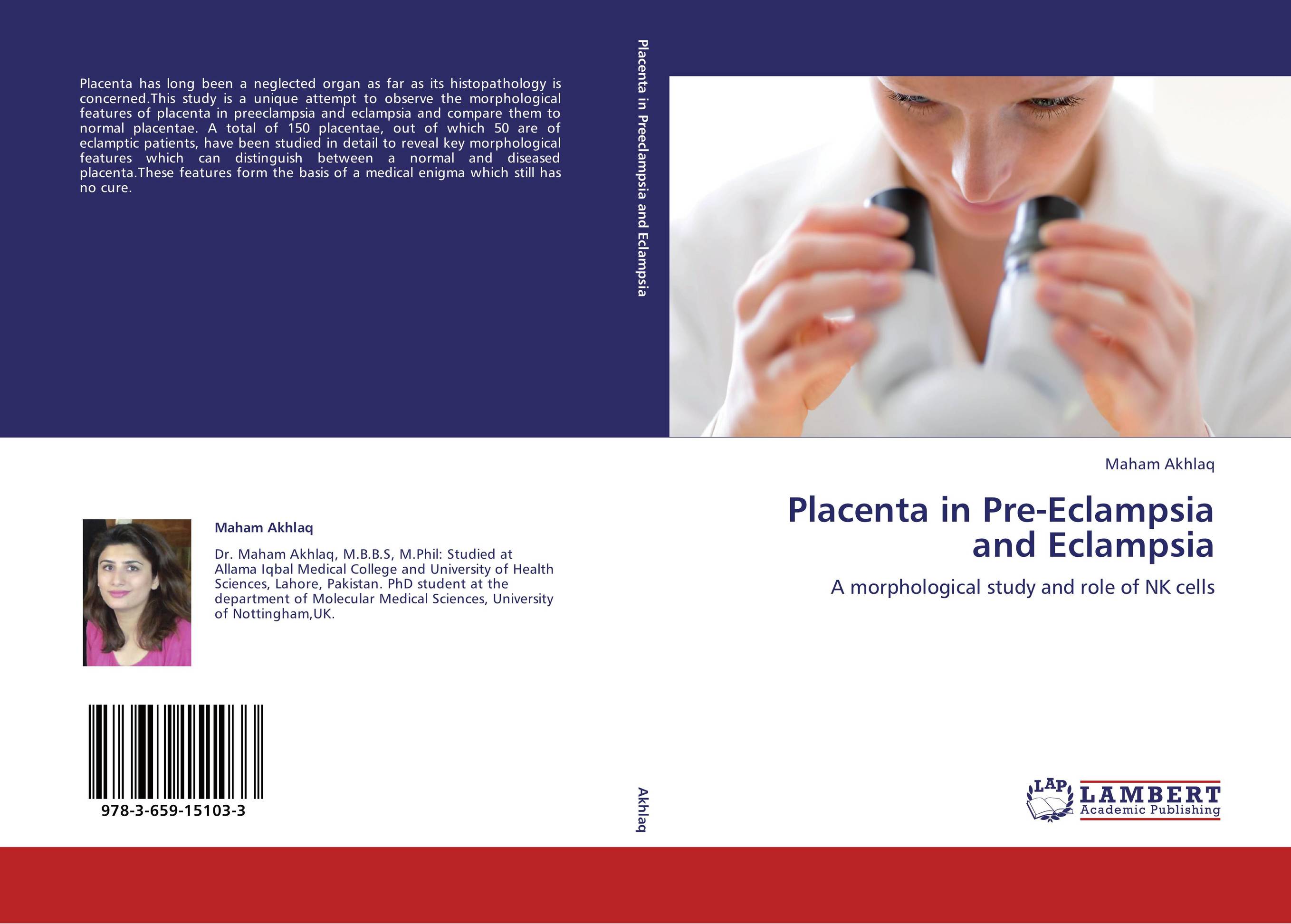 Placenta in Pre-Eclampsia and Eclampsia. A morphological study and role of NK cells.