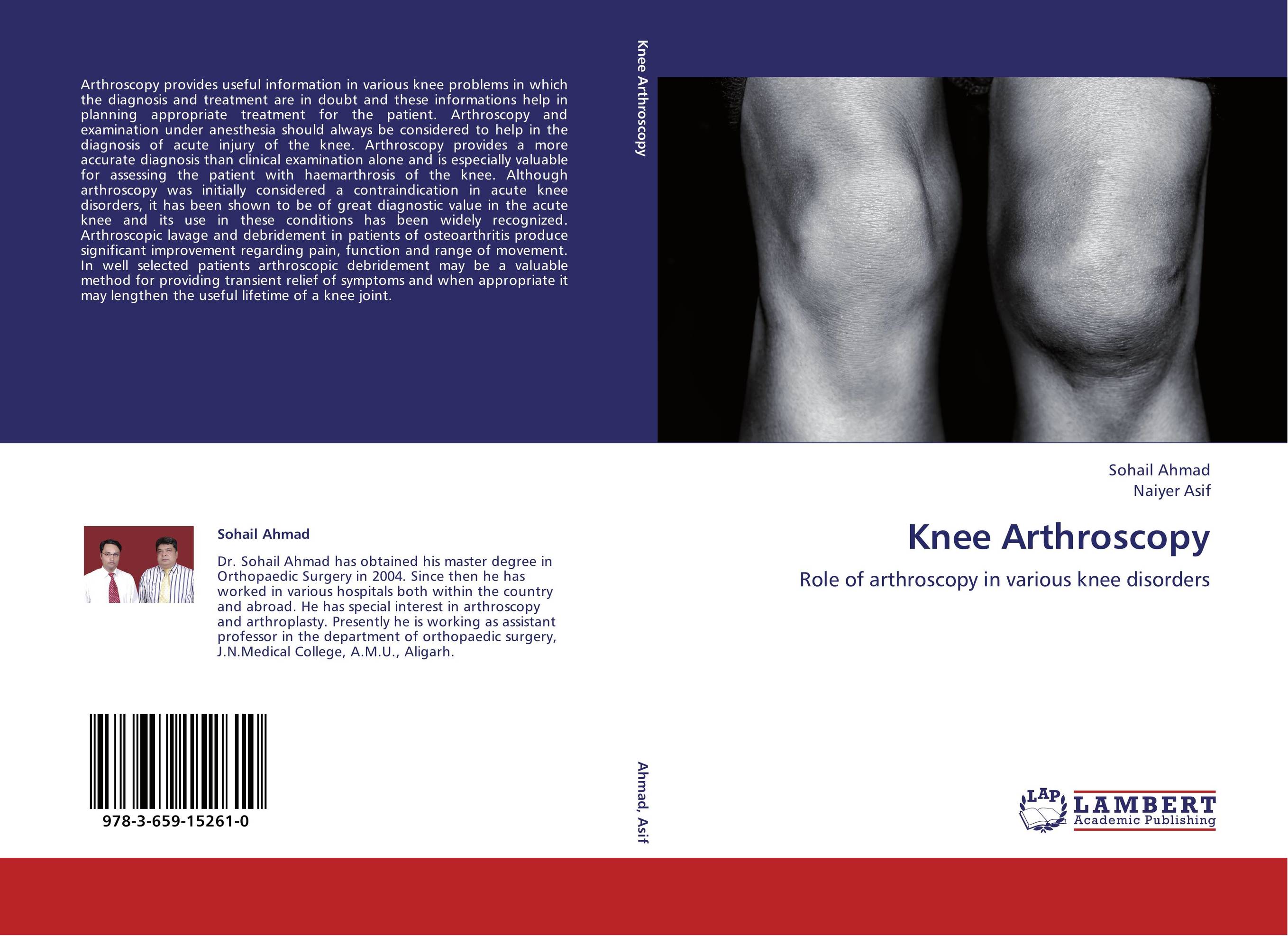 Knee Arthroscopy. Role of arthroscopy in various knee disorders.