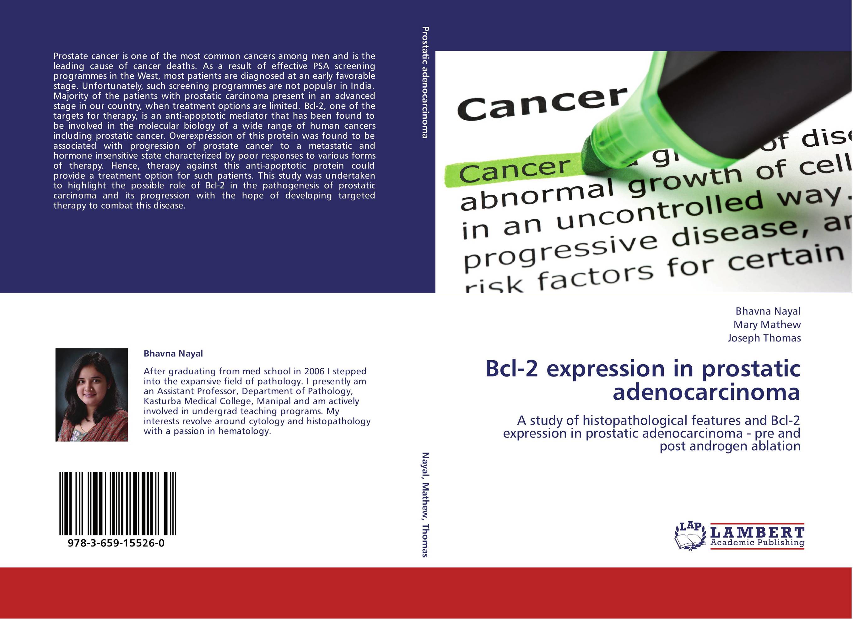 Bcl-2 expression in prostatic adenocarcinoma. A study of histopathological features and Bcl-2 expression in prostatic adenocarcinoma - pre and post androgen ablation.
