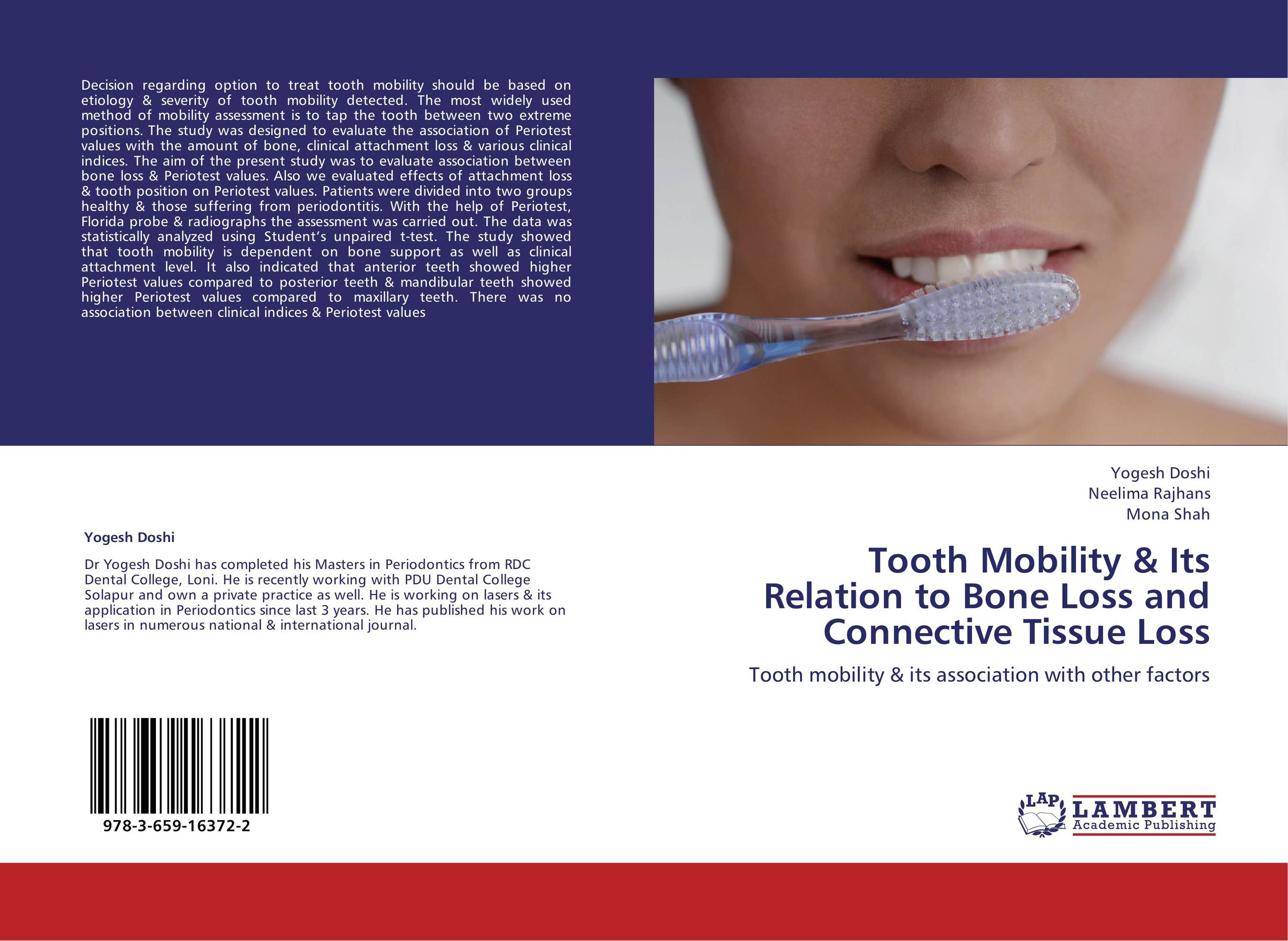 Tooth Mobility &amp;amp; Its Relation to Bone Loss and Connective Tissue Loss. Tooth mobility &amp;amp; its association with other factors.