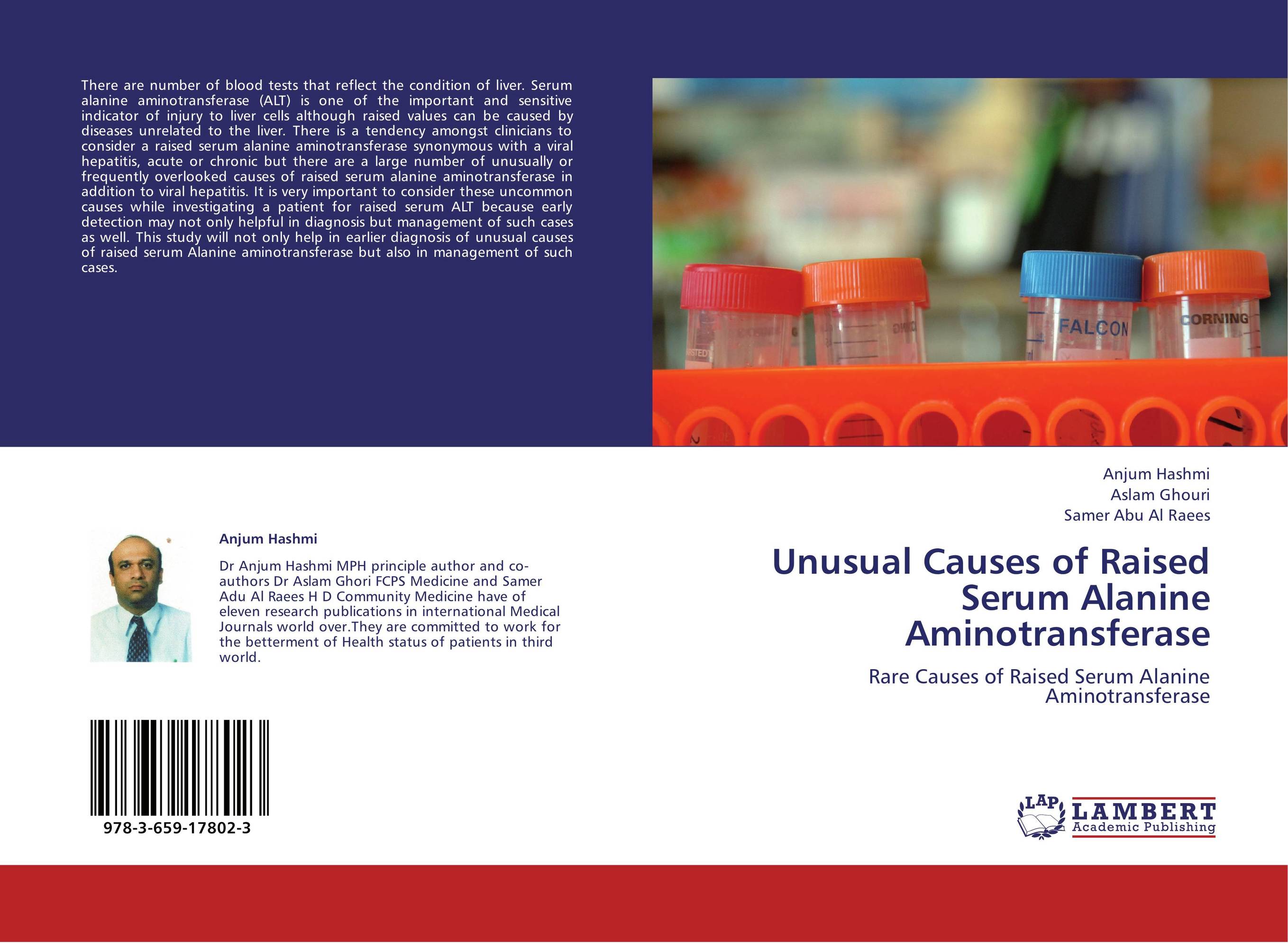 Unusual Causes of Raised Serum Alanine Aminotransferase. Rare Causes of Raised Serum Alanine Aminotransferase.