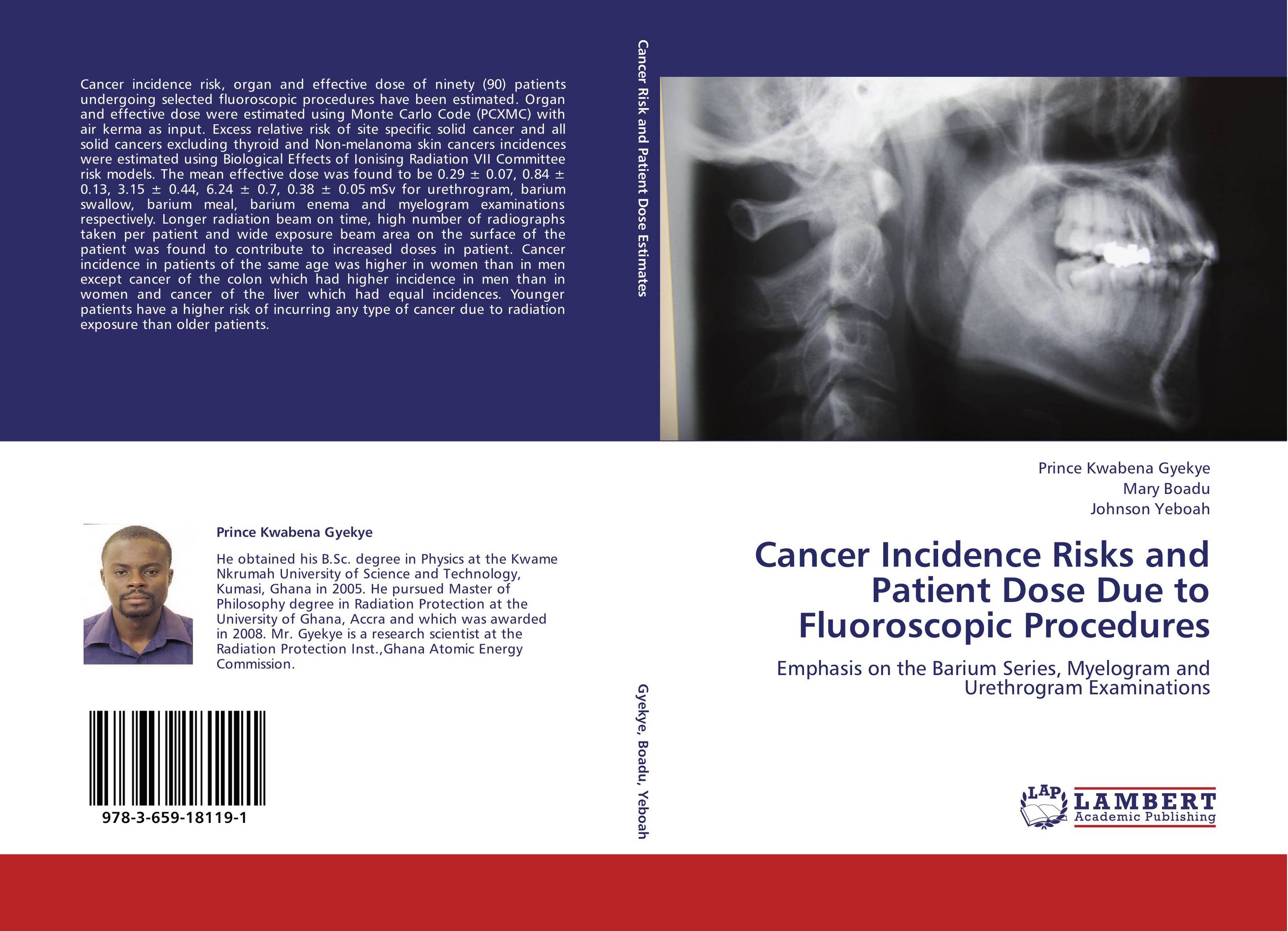 9783659181191 Cancer Incidence Risks and Patient Dose Due to Fluic Procedures 9783659181191 Cancer Incidence Risks and Patient Dose Due to Fluic Procedures
