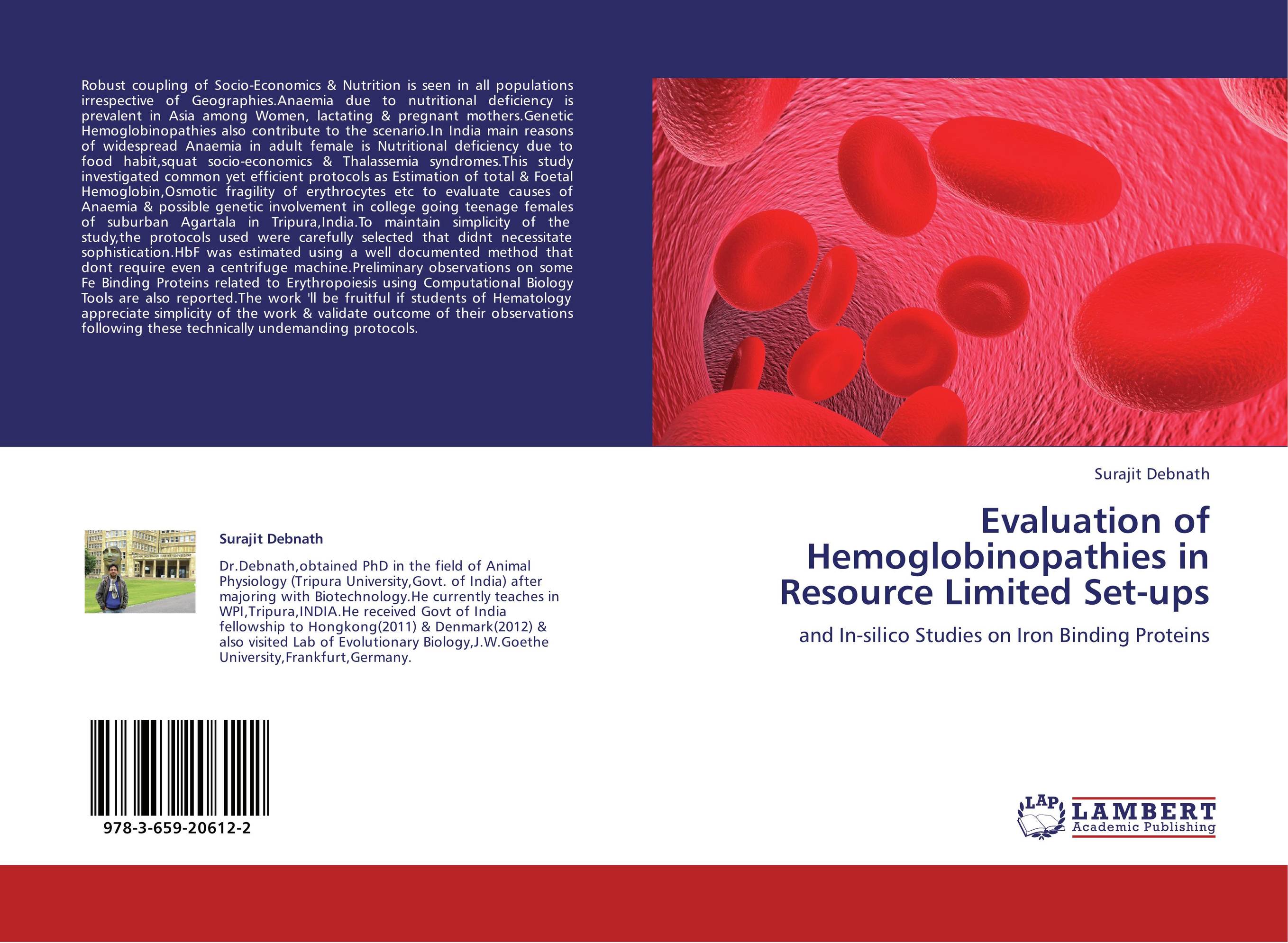 Evaluation of Hemoglobinopathies in Resource Limited Set-ups. And In-silico Studies on Iron Binding Proteins.