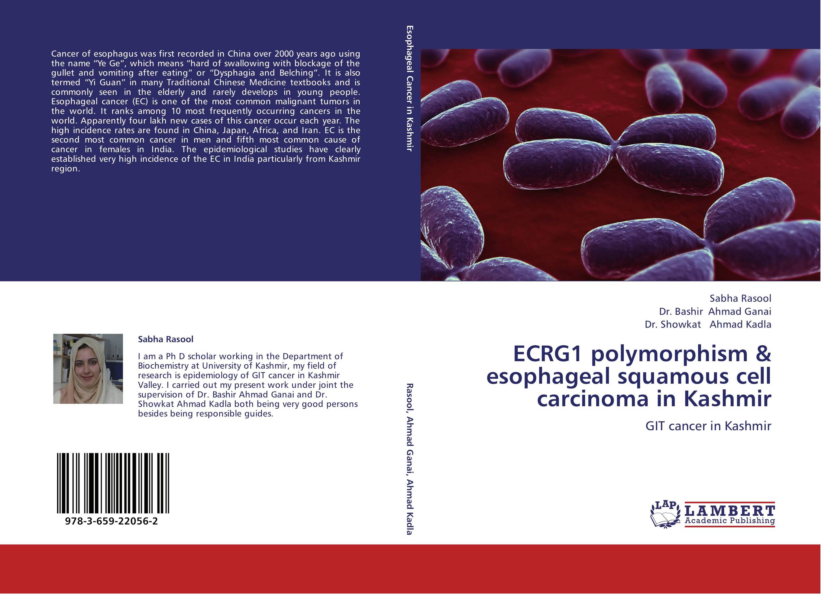 ECRG1 polymorphism &amp;amp; esophageal squamous cell carcinoma in Kashmir. GIT cancer in Kashmir.