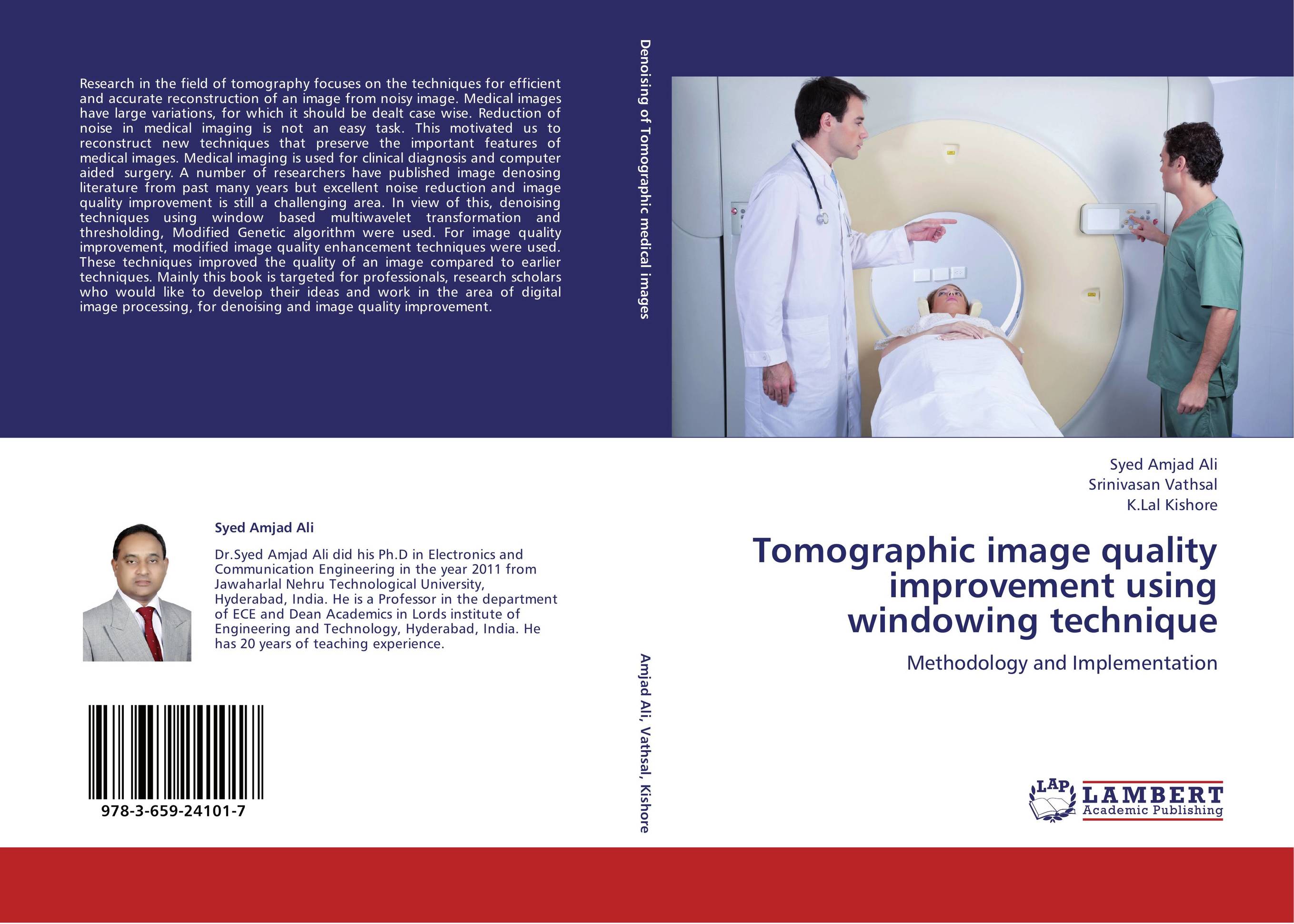 Tomographic image quality improvement using windowing technique. Methodology and Implementation.
