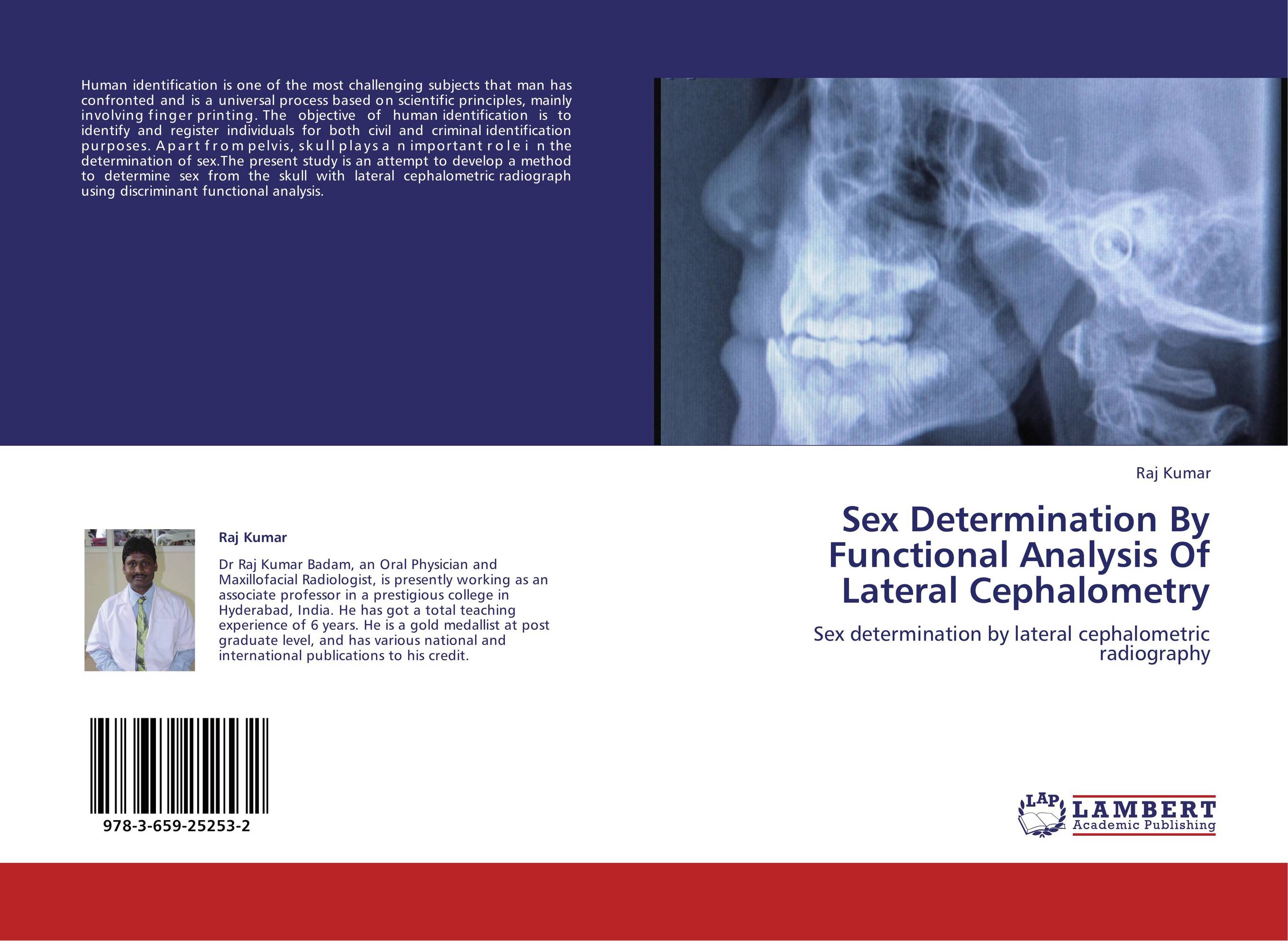 Sex Determination By Functional Analysis Of Lateral Cephalometry. Sex determination by lateral cephalometric radiography.