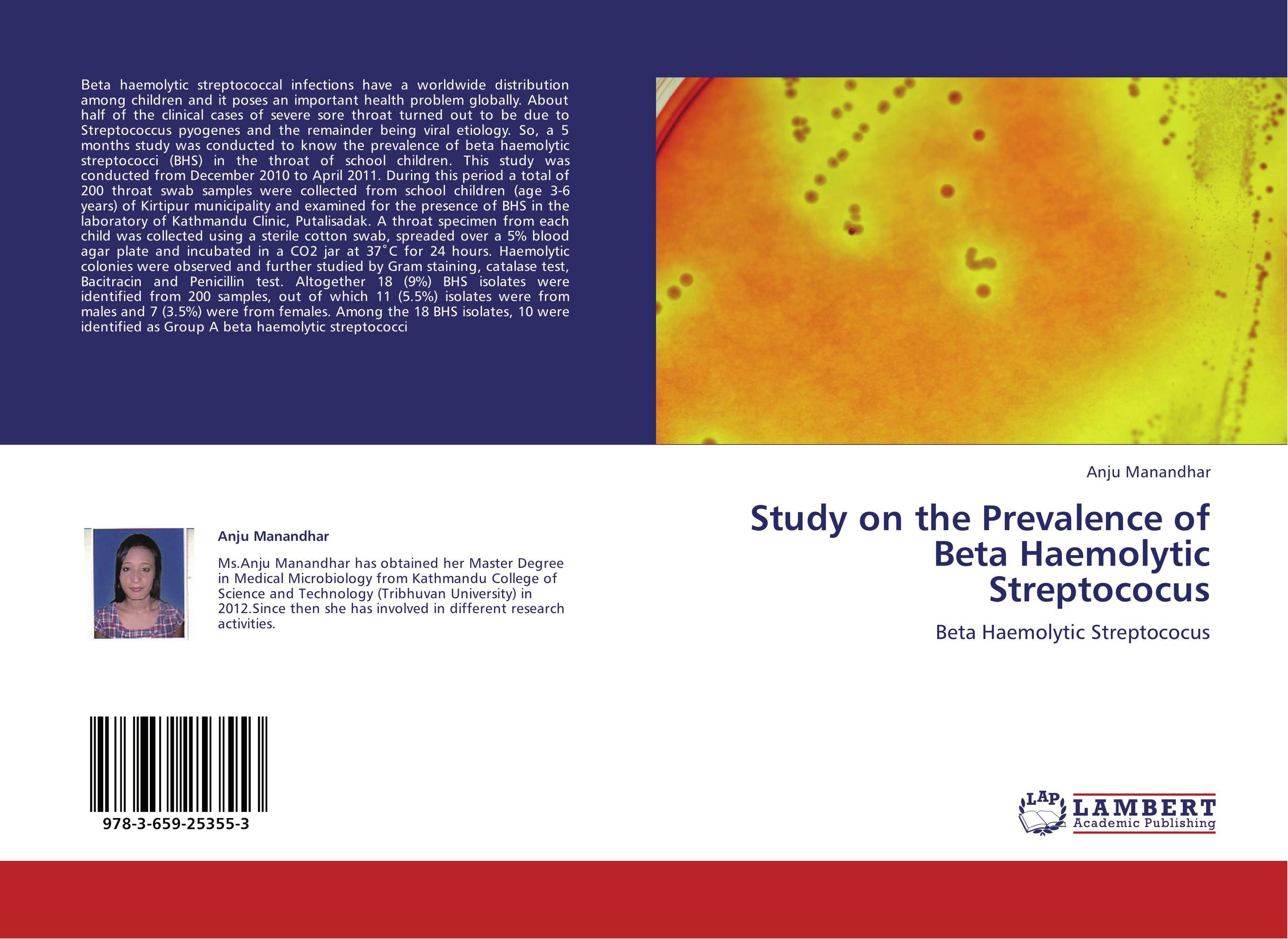 Study on the Prevalence of Beta Haemolytic             Streptococus. Beta Haemolytic Streptococus.