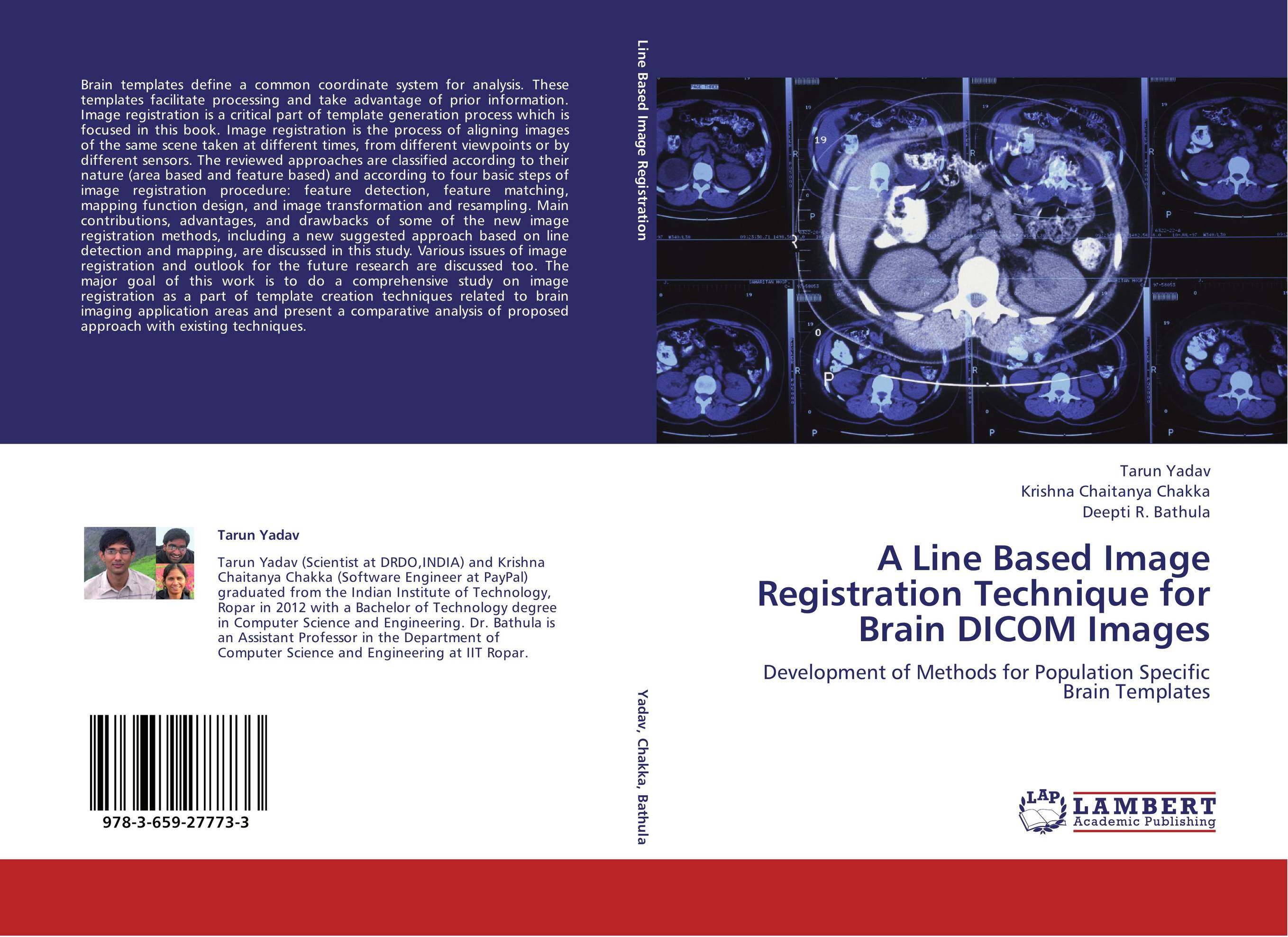 A Line Based Image Registration Technique for Brain DICOM Images. Development of Methods for Population Specific Brain Templates.
