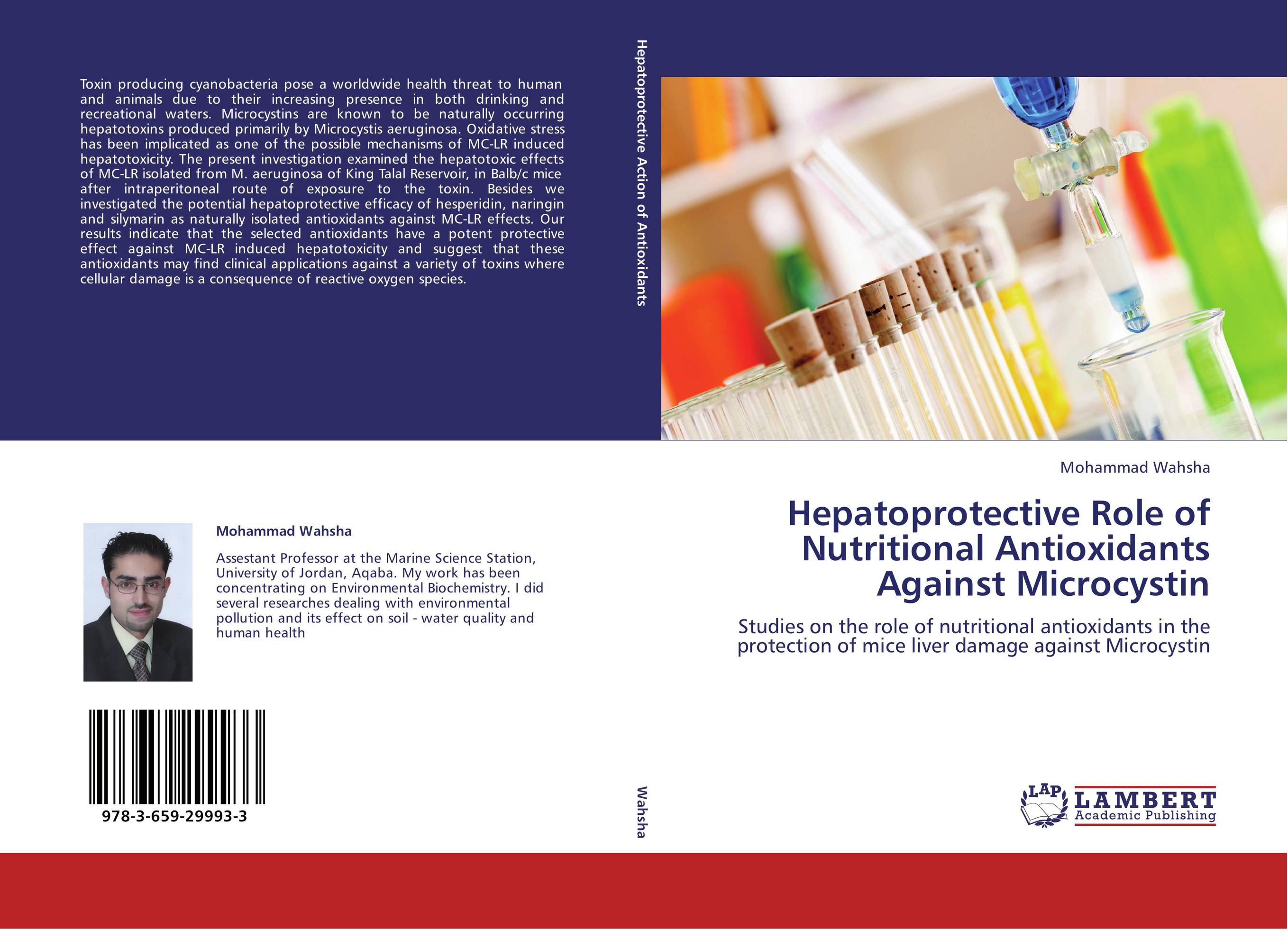 Hepatoprotective Role of Nutritional Antioxidants Against Microcystin. Studies on the role of nutritional antioxidants in the protection of mice liver damage against Microcystin.