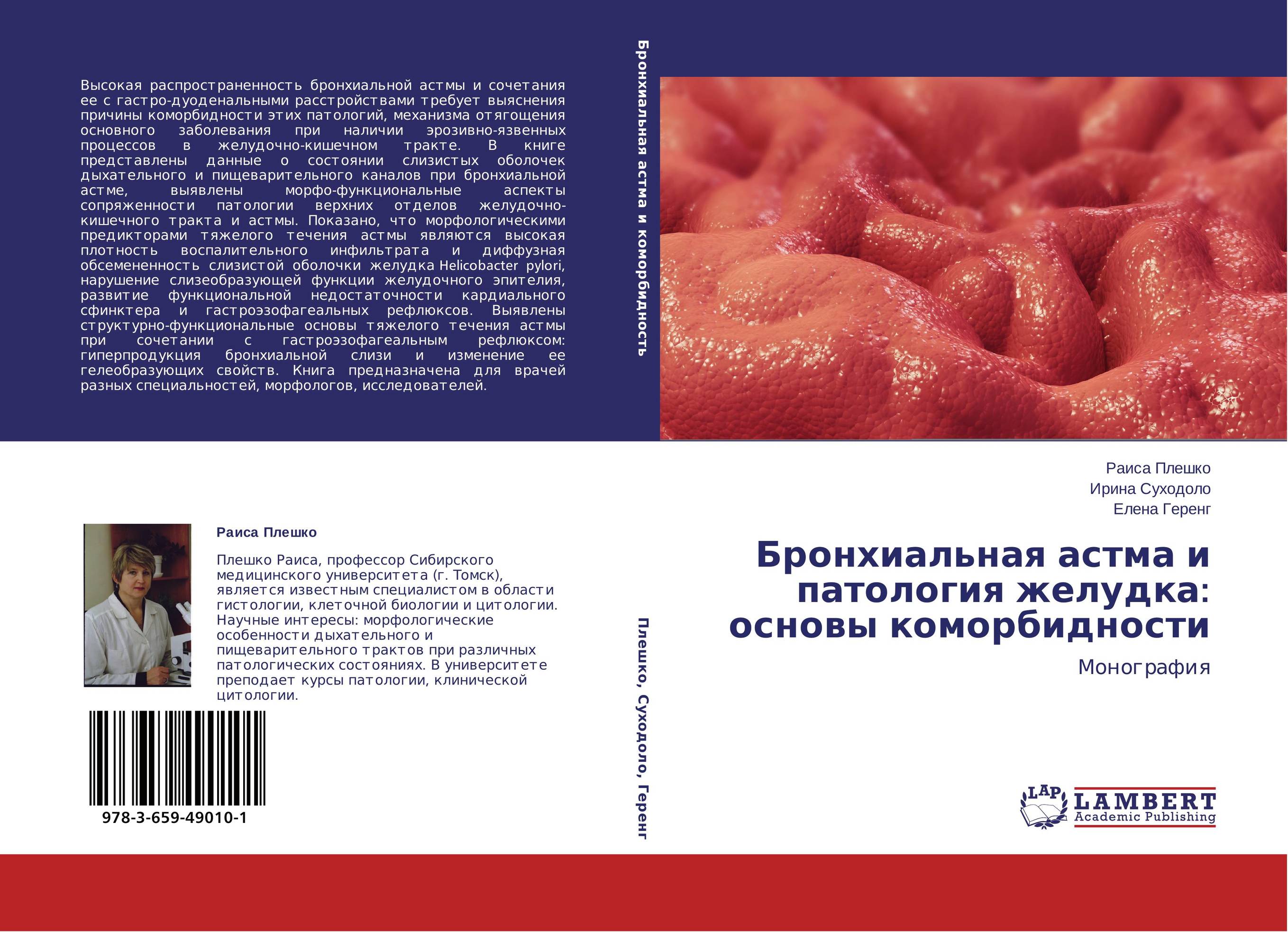 Бронхиальная астма и патология желудка: основы коморбидности. Монография.