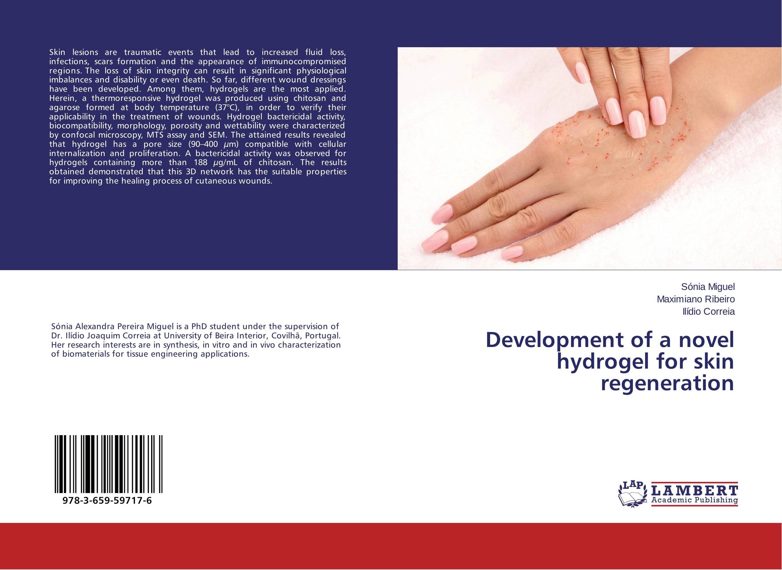 Development of a novel hydrogel for skin regeneration..