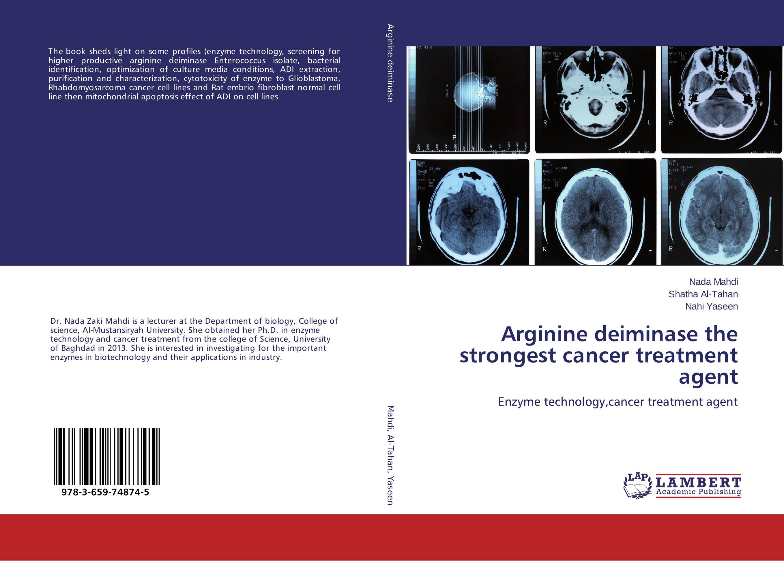 Arginine deiminase the strongest cancer treatment agent. Enzyme technology,cancer treatment agent.