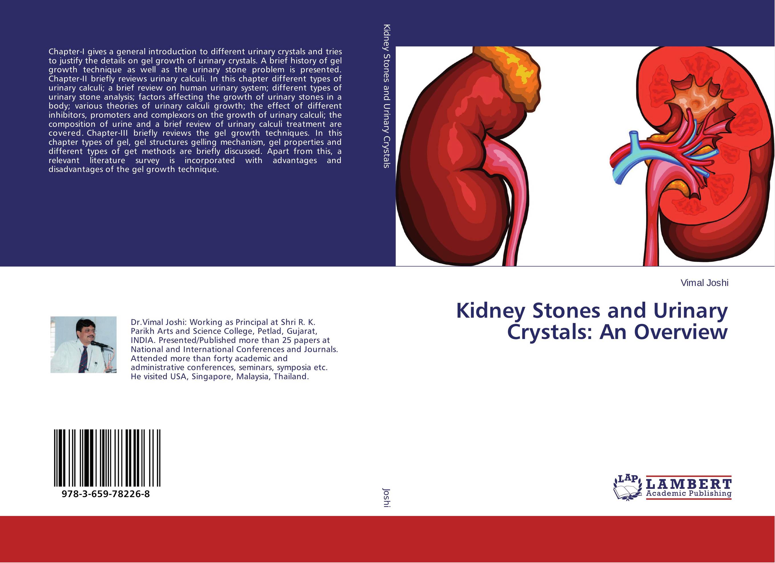 Kidney Stones and Urinary Crystals: An Overview..