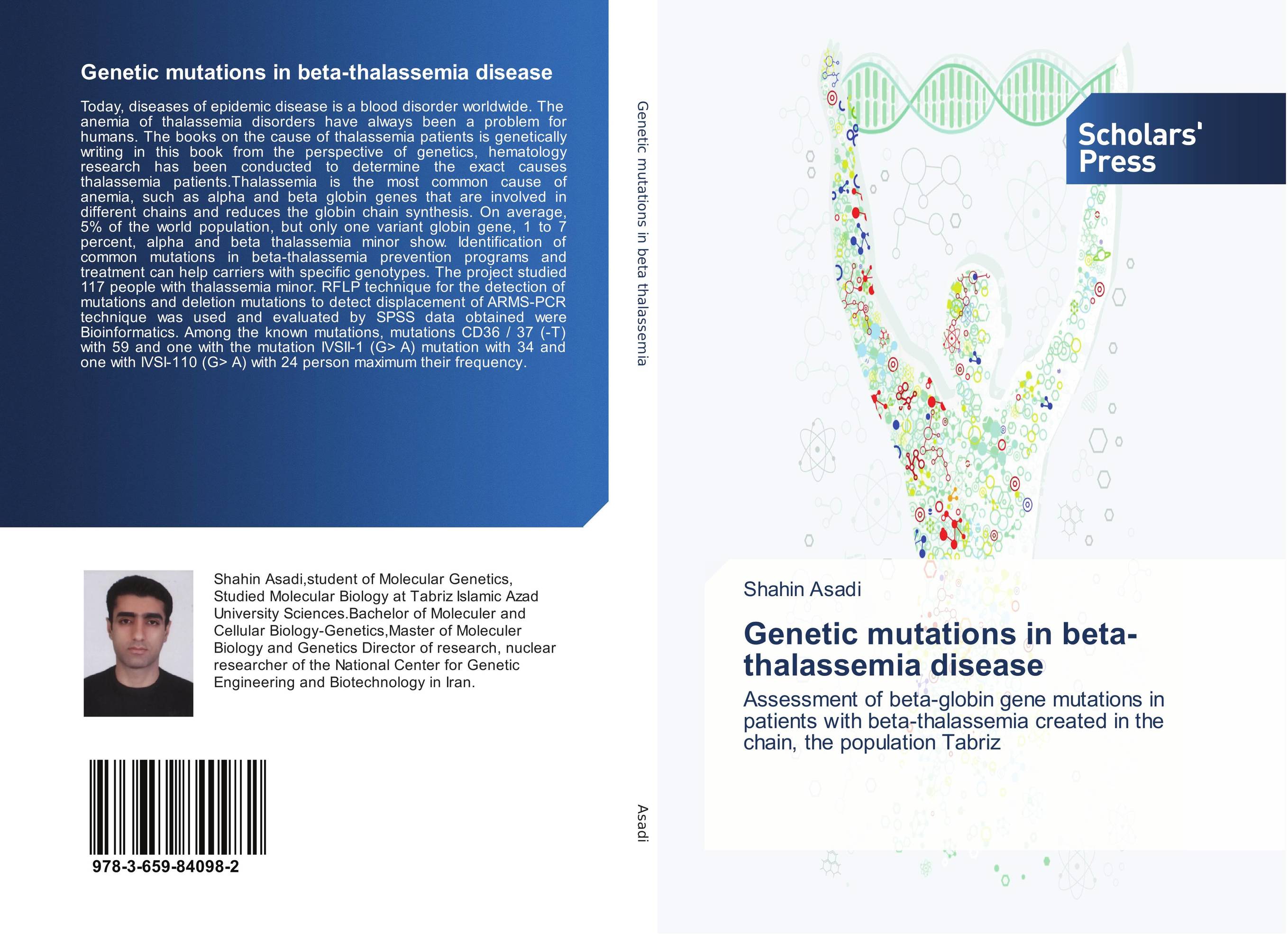Genetic mutations in beta-thalassemia disease. Assessment of beta-globin gene mutations in patients with beta-thalassemia created in the chain, the population Tabriz.