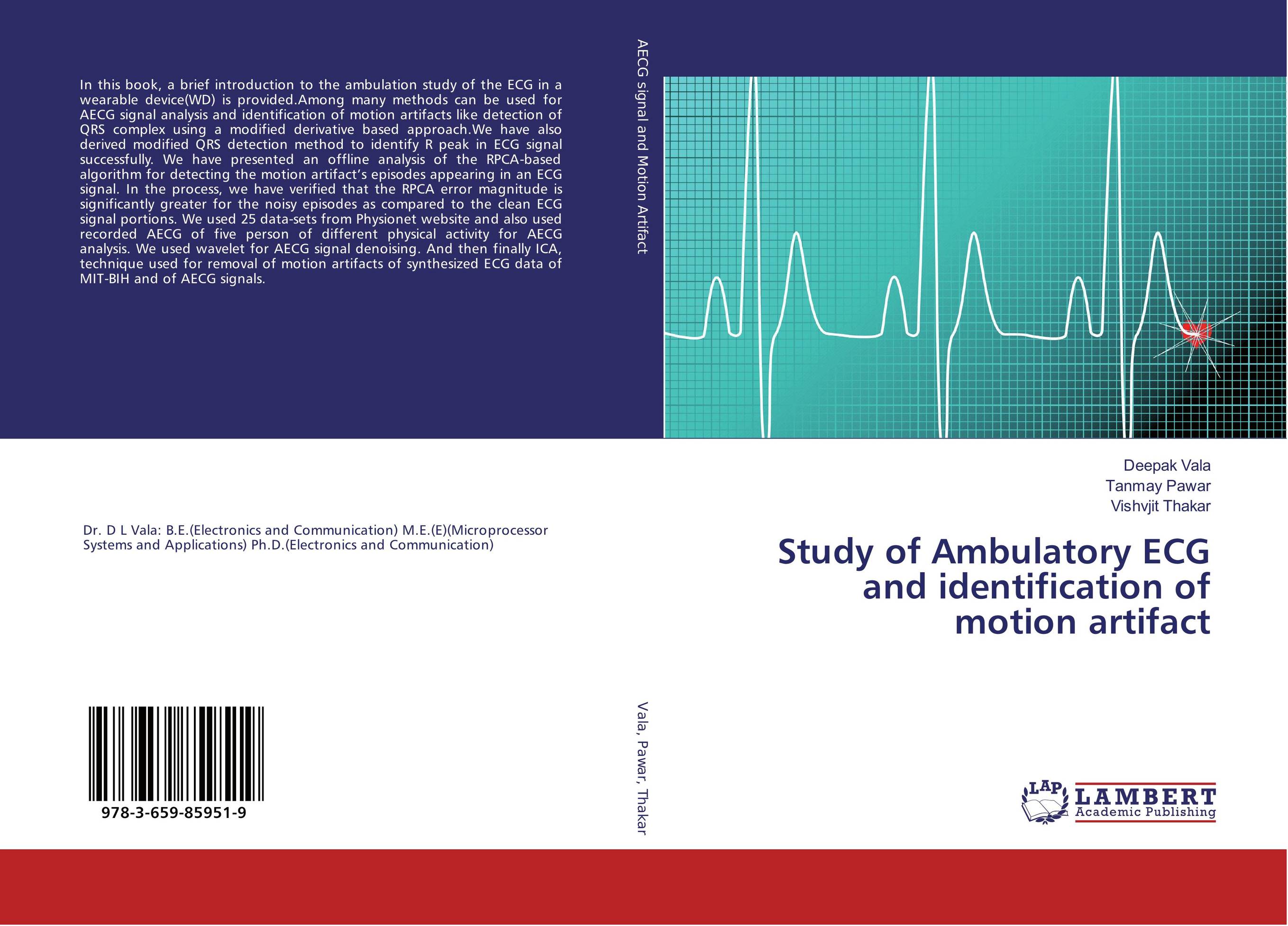 Study of Ambulatory ECG and identification of motion artifact..