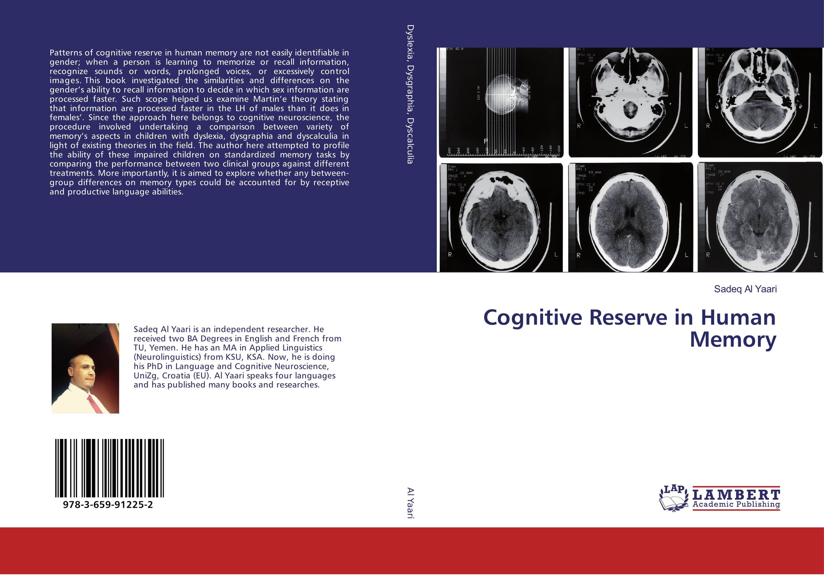 Cognitive Reserve in Human Memory..