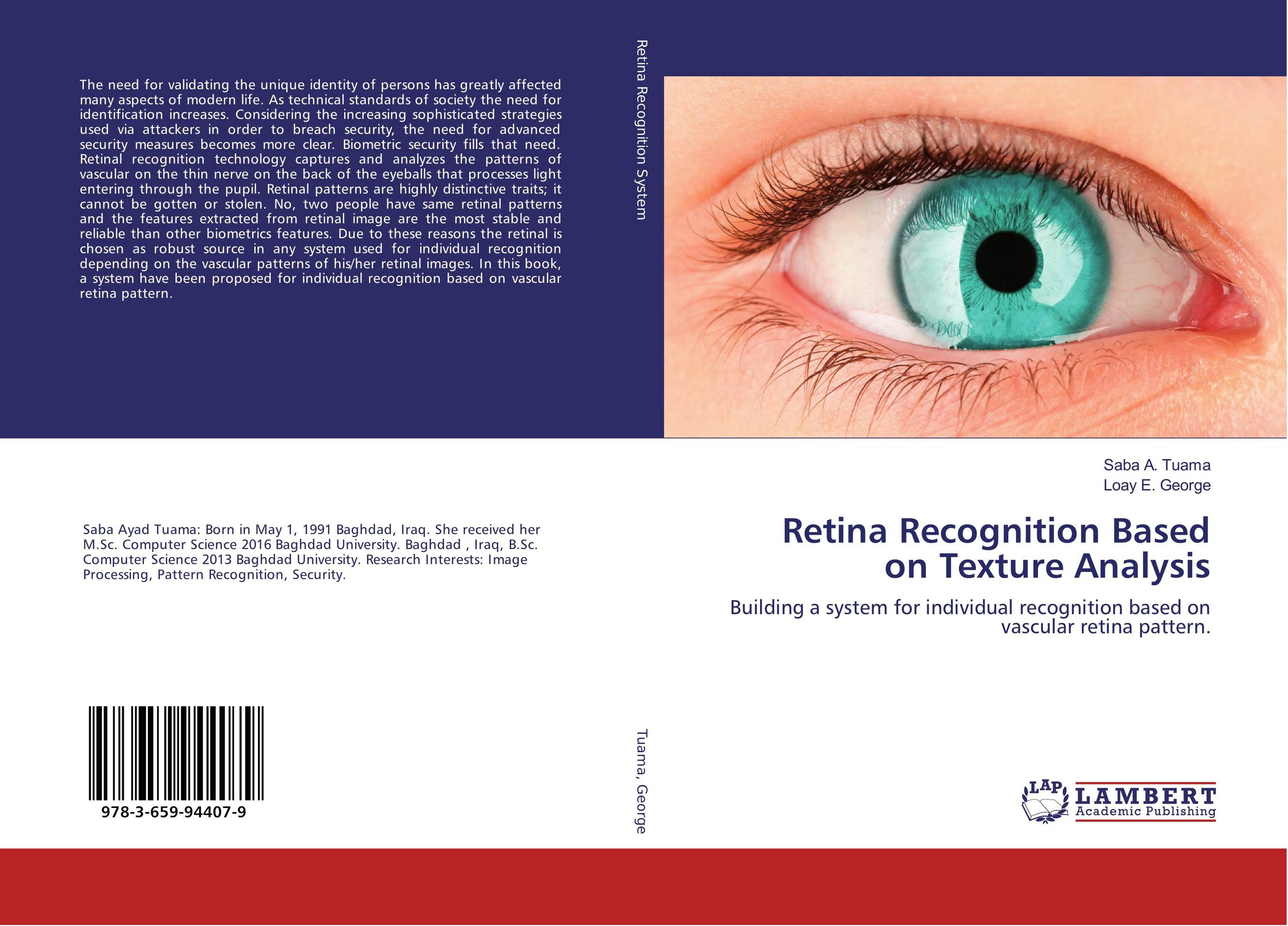 Retina Recognition Based on Texture Analysis. Building a system for individual recognition based on vascular retina pattern..