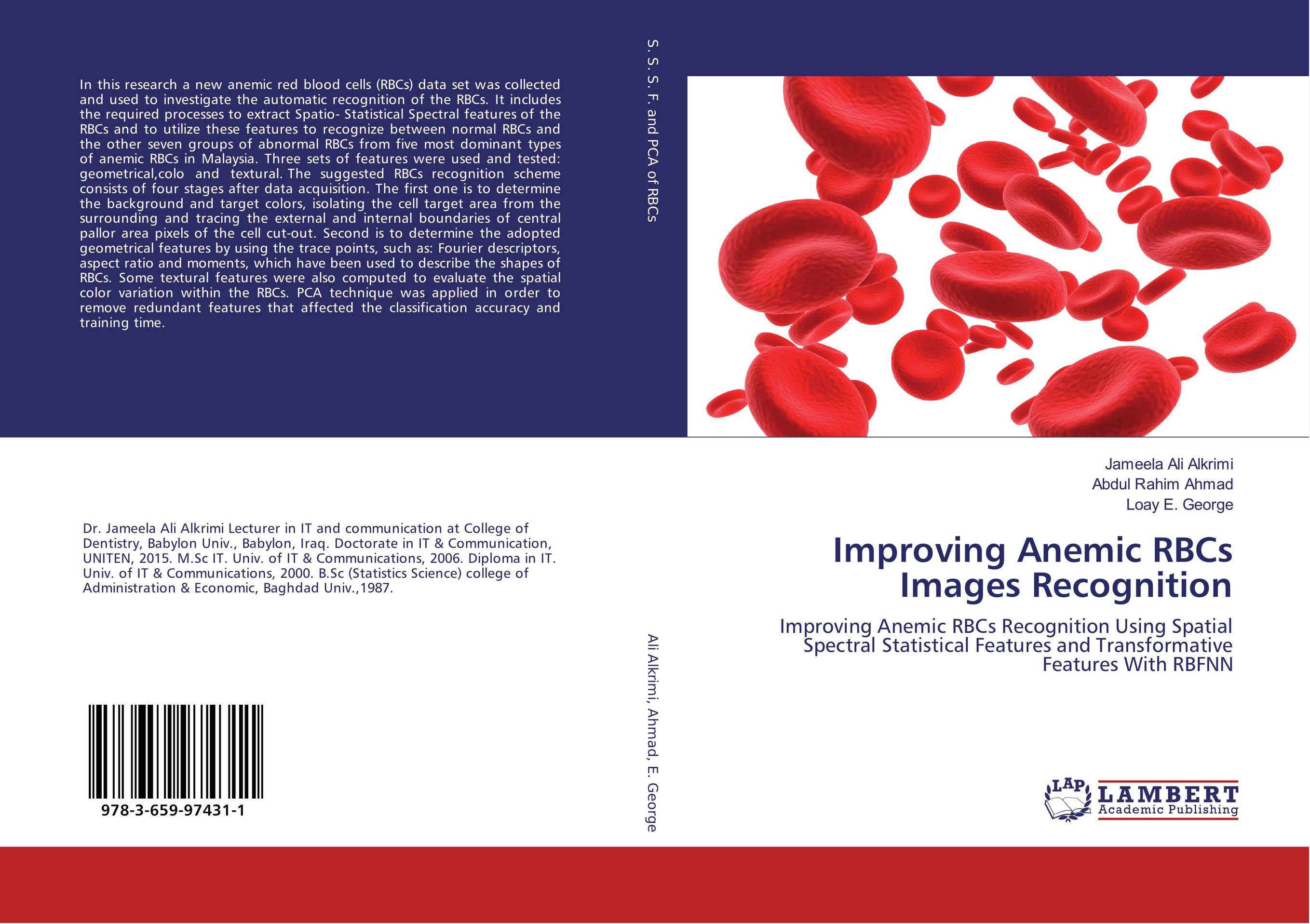 Improving Anemic RBCs Images Recognition. Improving Anemic RBCs Recognition Using Spatial Spectral Statistical Features and Transformative Features With RBFNN.