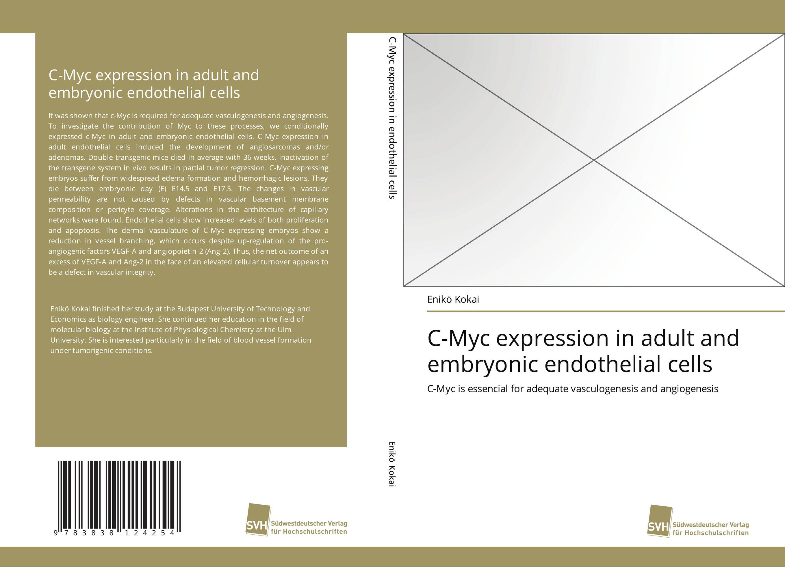 C-Myc expression in adult and embryonic endothelial cells. C-Myc is essencial for adequate vasculogenesis and angiogenesis.