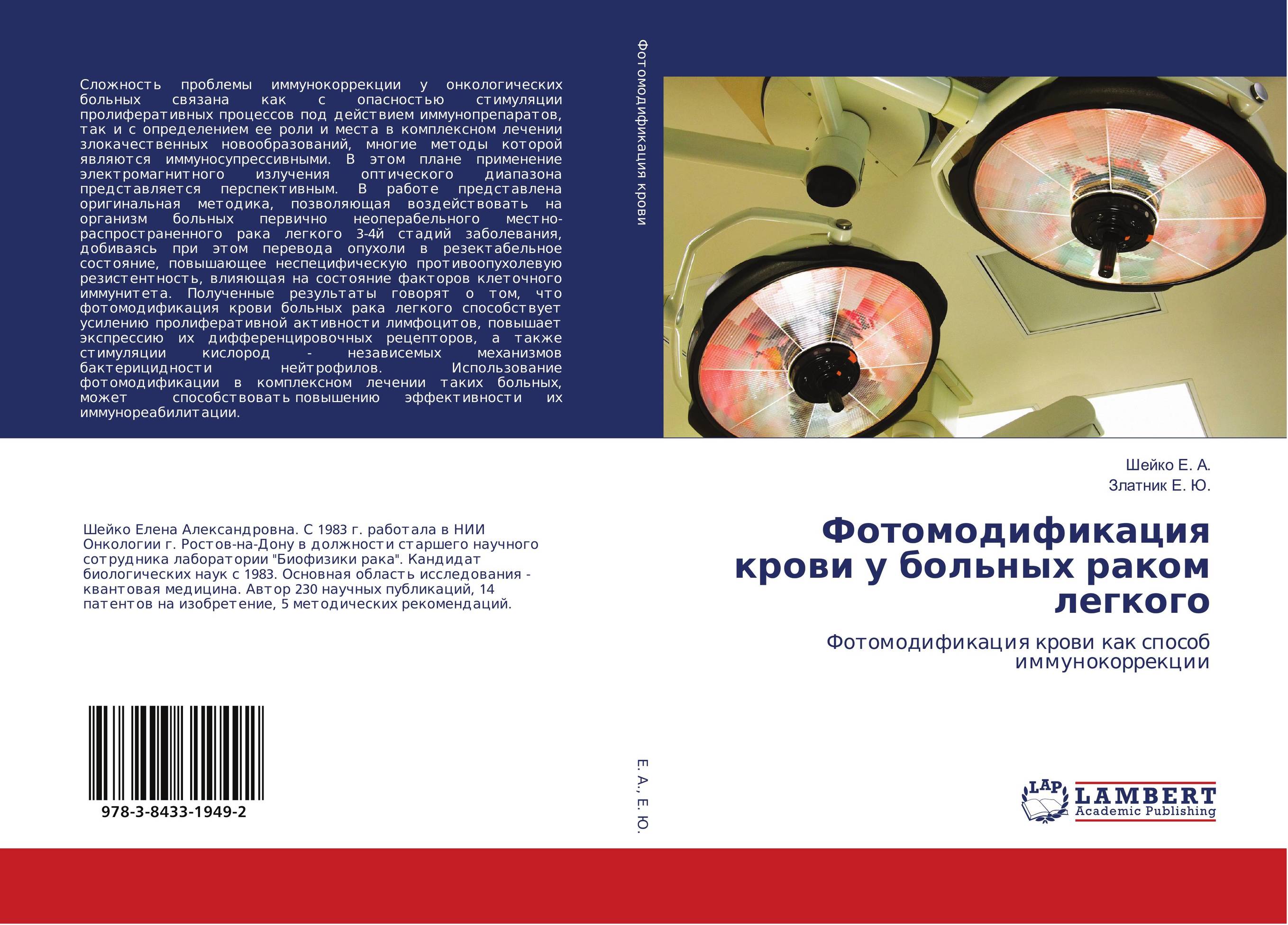 Фотомодификация крови у больных раком легкого. Фотомодификация крови как способ иммунокоррекции.