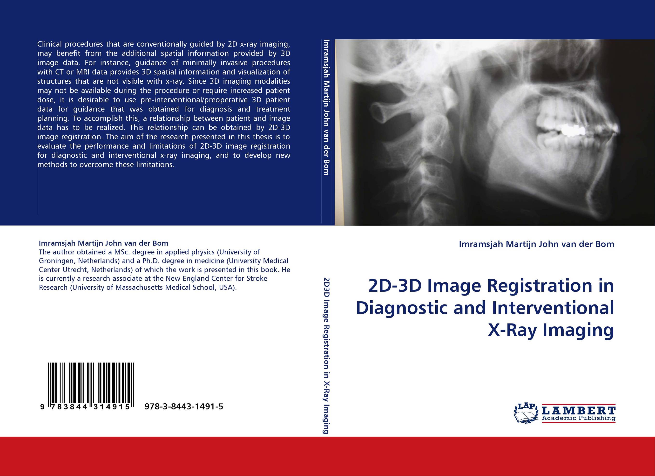 2D-3D Image Registration in Diagnostic and Interventional X-Ray Imaging..