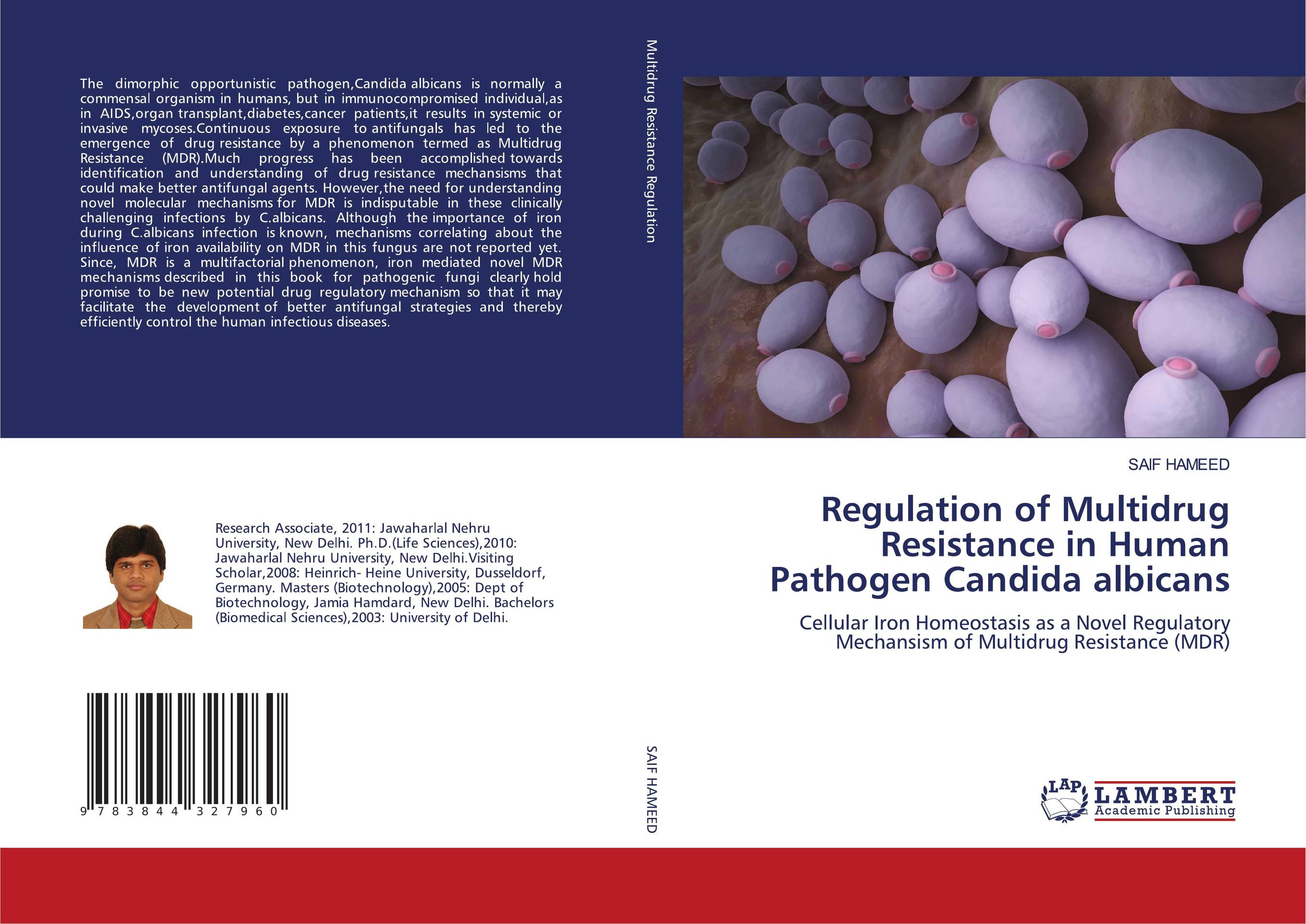 Regulation of Multidrug Resistance in Human Pathogen Candida albicans. Cellular Iron Homeostasis as a Novel Regulatory Mechansism of Multidrug Resistance (MDR).