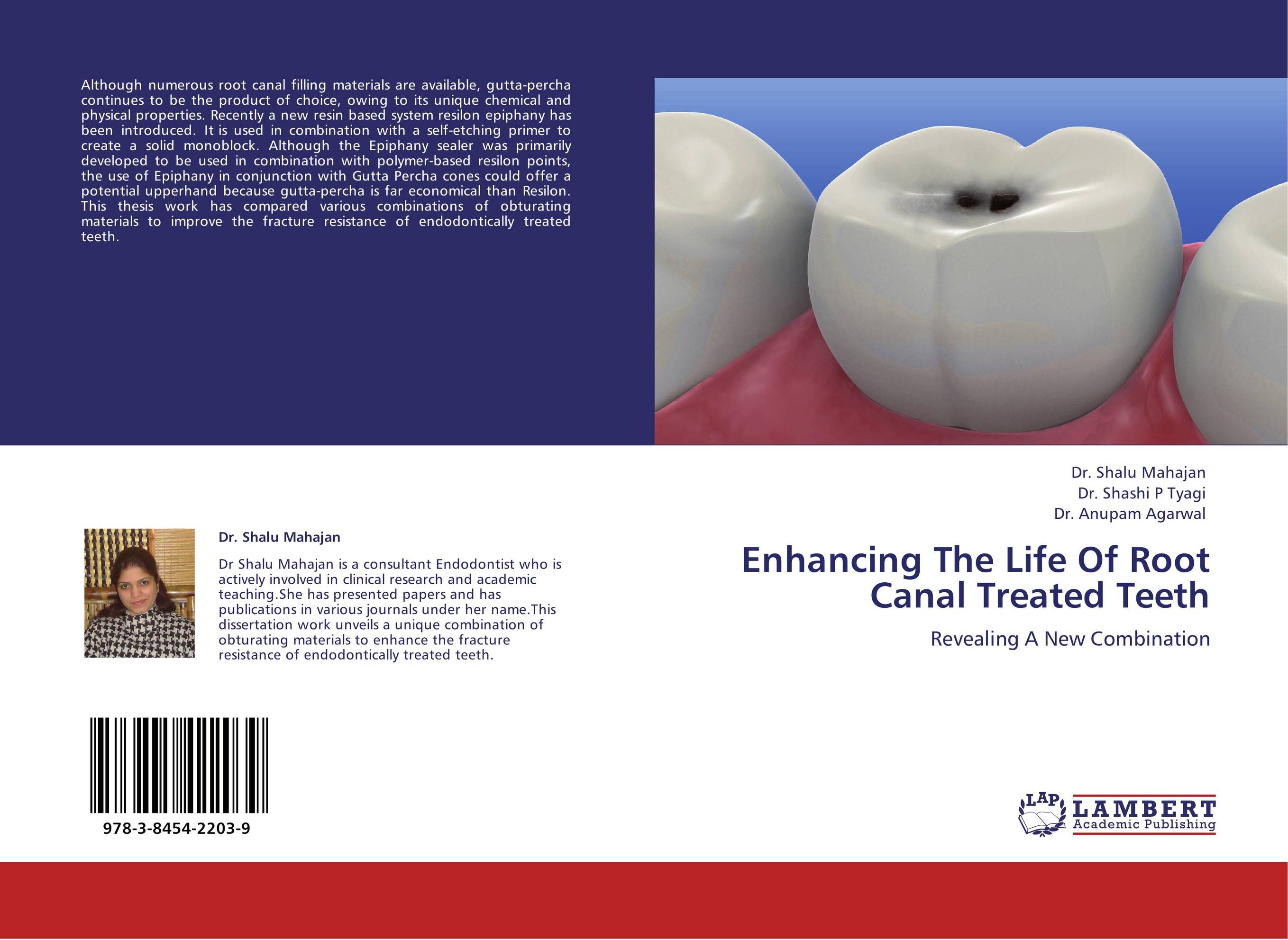 Enhancing The Life Of Root Canal Treated Teeth. Revealing A New Combination.