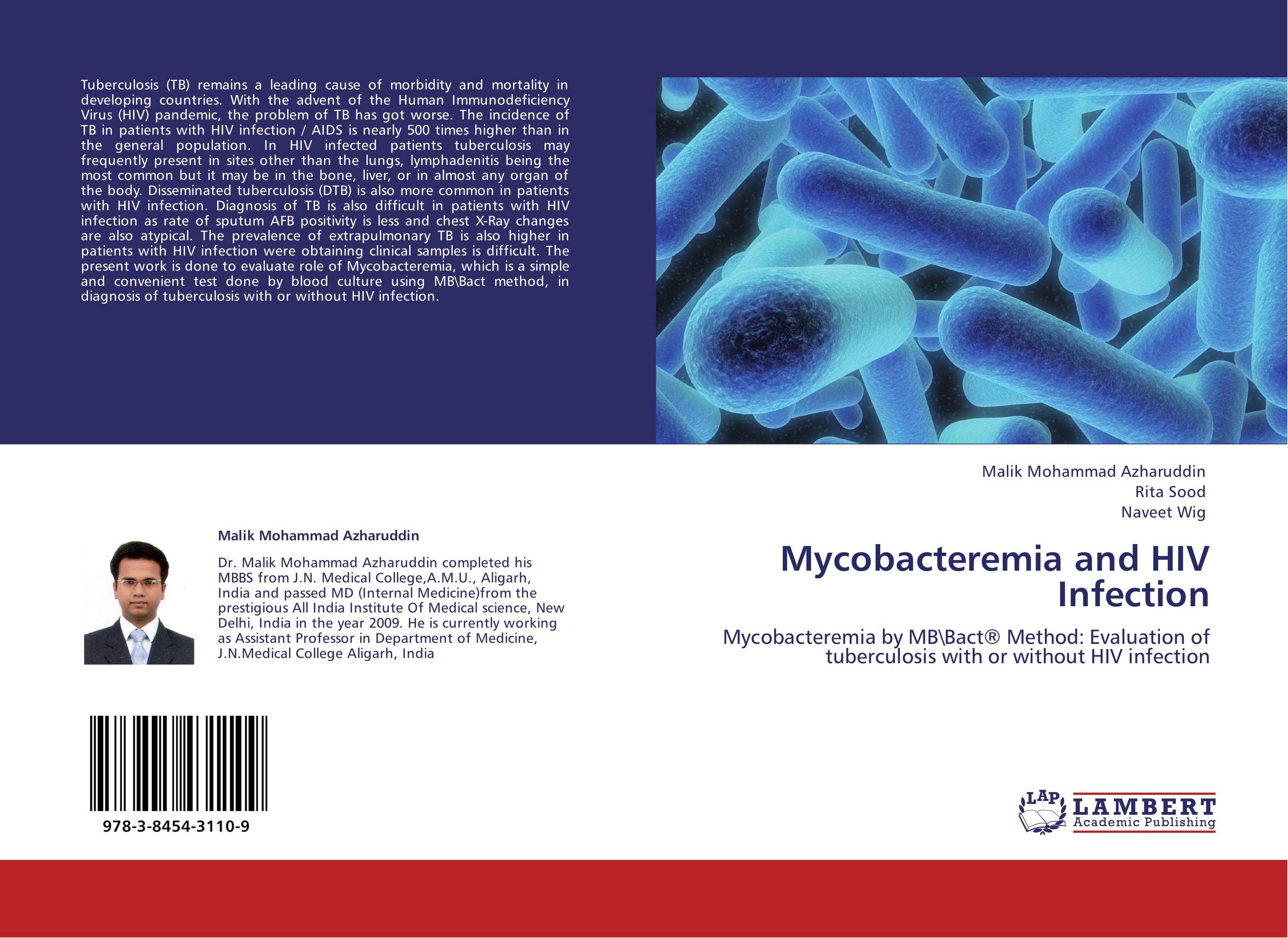 Mycobacteremia and HIV Infection. Mycobacteremia by MBBact® Method: Evaluation of tuberculosis with or without HIV infection.