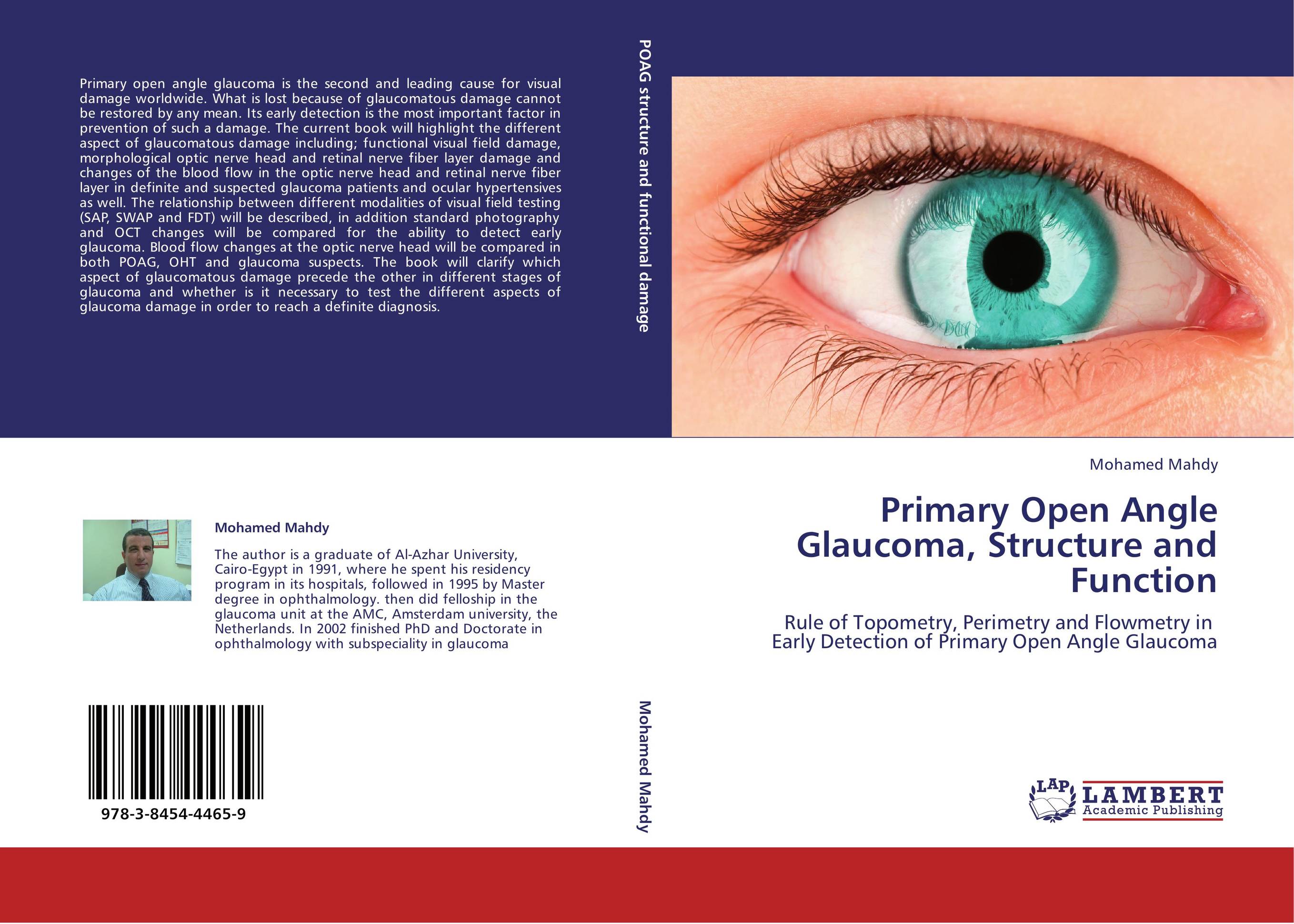 Primary Open Angle Glaucoma, Structure and Function. Rule of Topometry, Perimetry and Flowmetry in   Early Detection of Primary Open Angle Glaucoma.