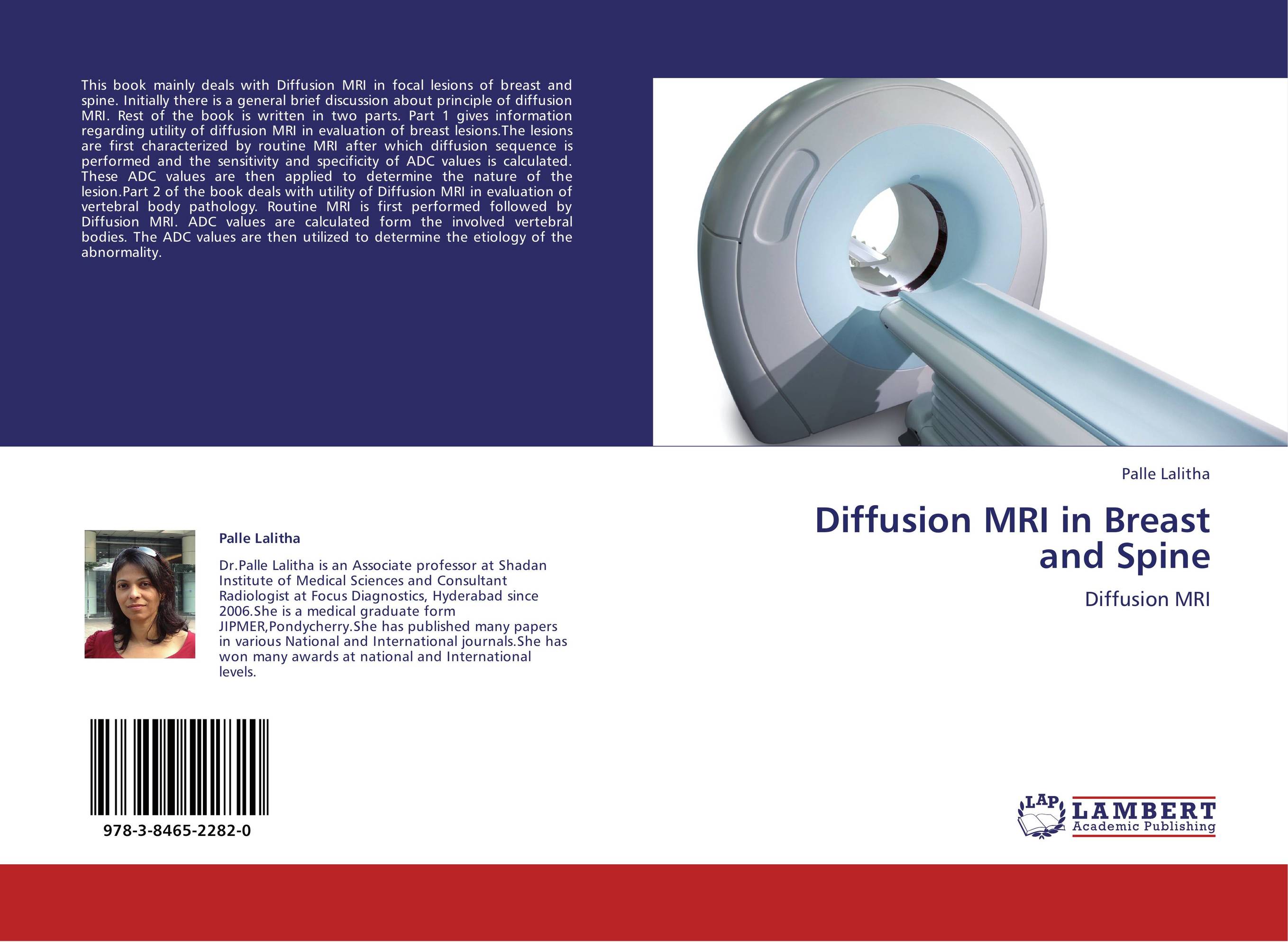 Diffusion MRI in Breast  and Spine. Diffusion MRI.
