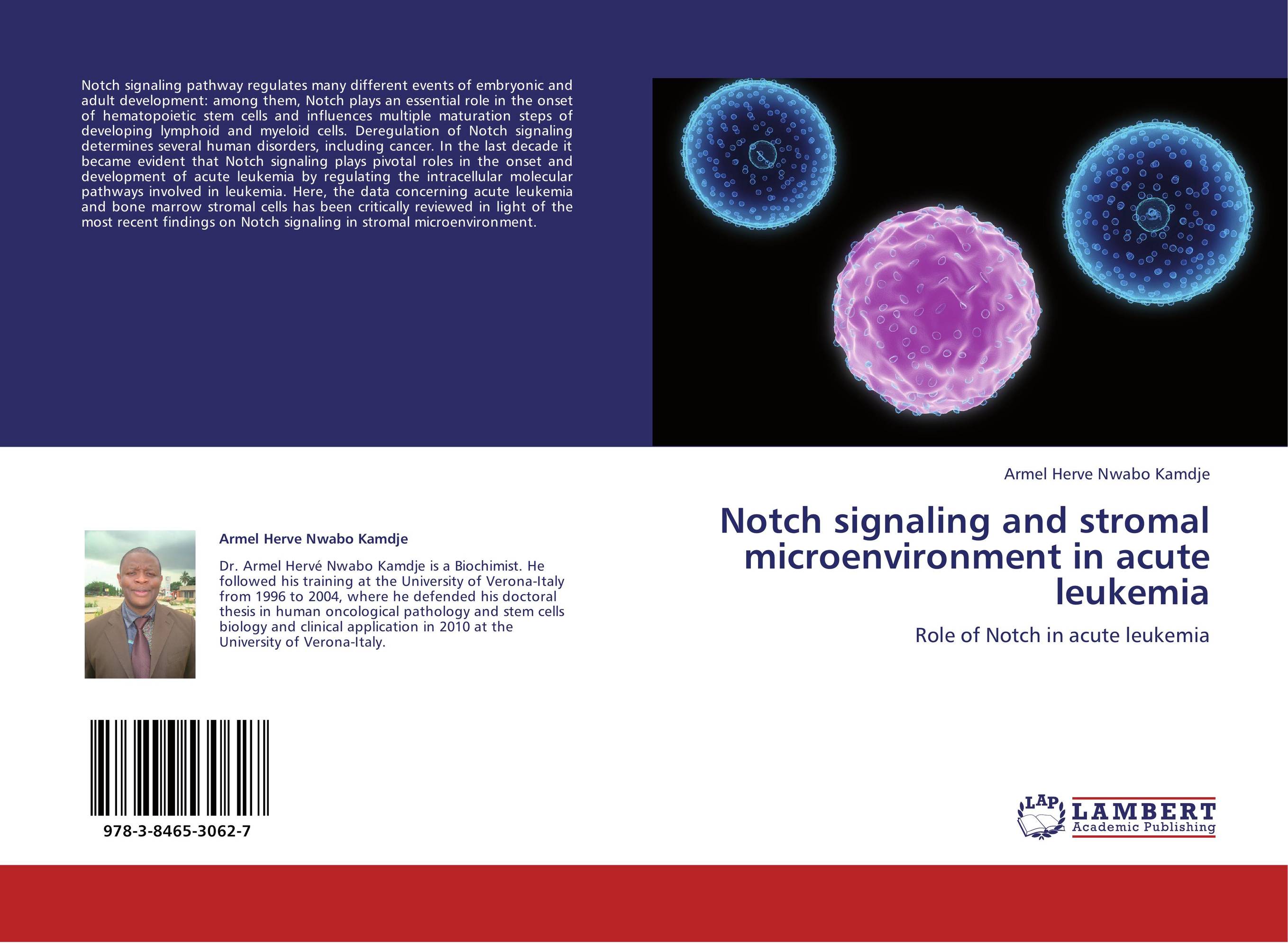 Notch signaling and stromal microenvironment in acute leukemia. Role of Notch in acute leukemia.