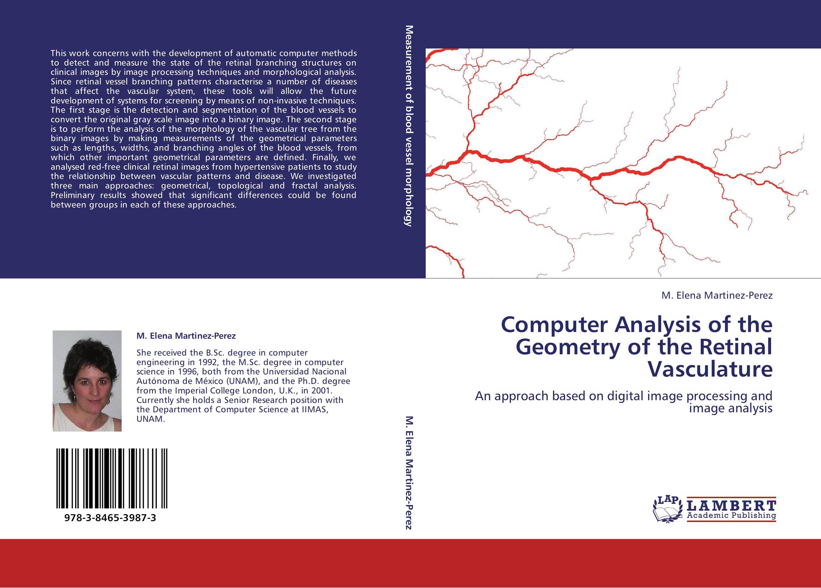 Computer Analysis of the Geometry of the Retinal Vasculature. An approach based on digital image processing and image analysis.