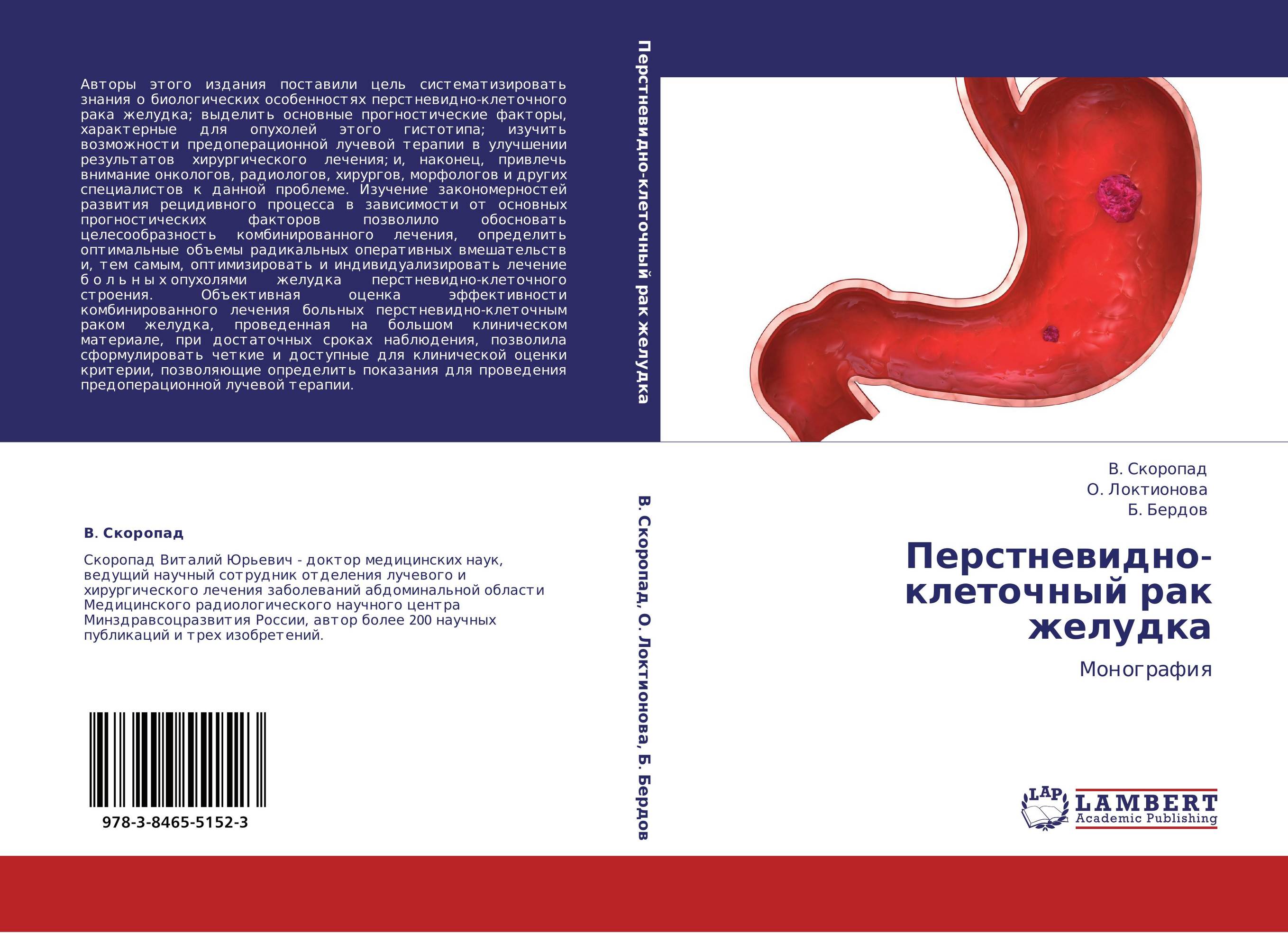 Перстневидно-клеточный рак желудка. Монография.