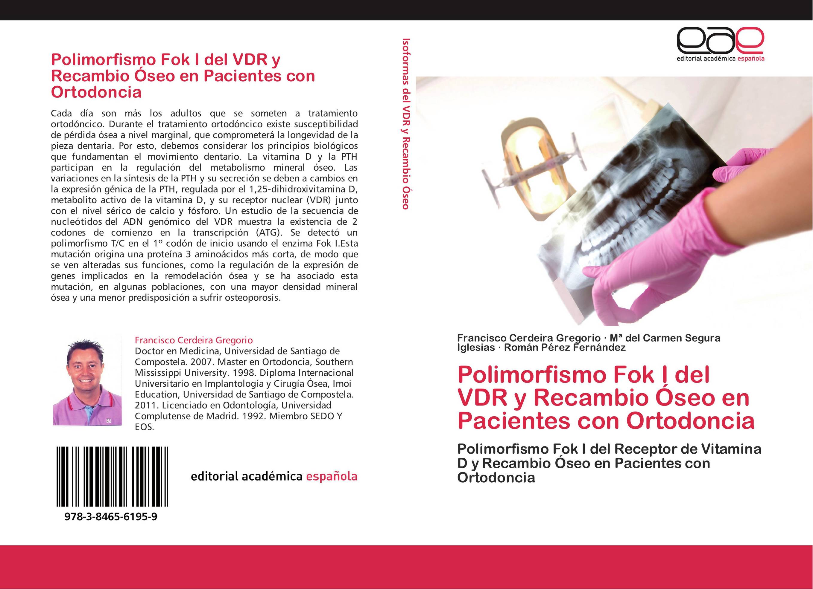 Polimorfismo Fok I del VDR y Recambio Óseo en Pacientes con Ortodoncia