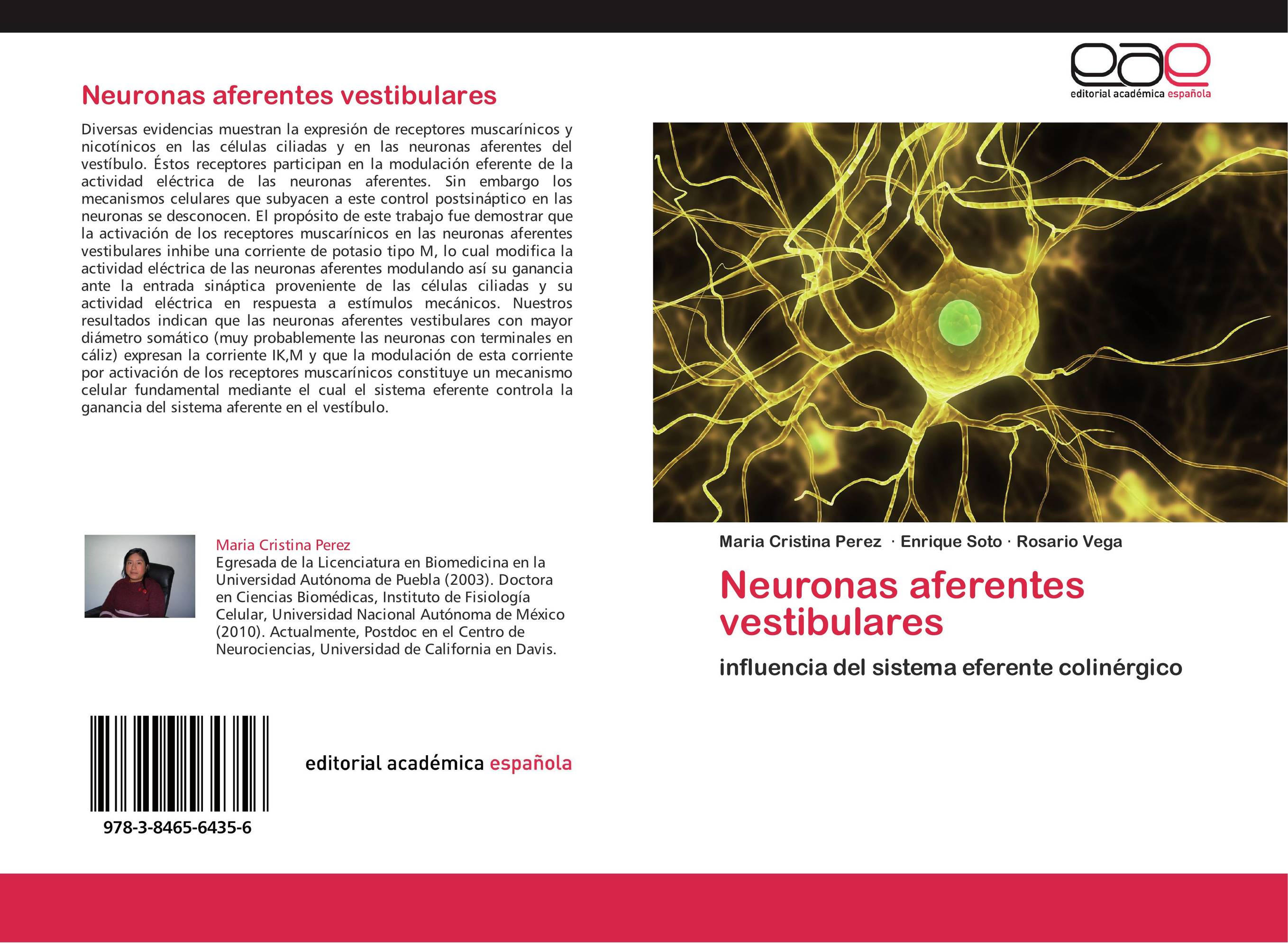 Neuronas aferentes vestibulares