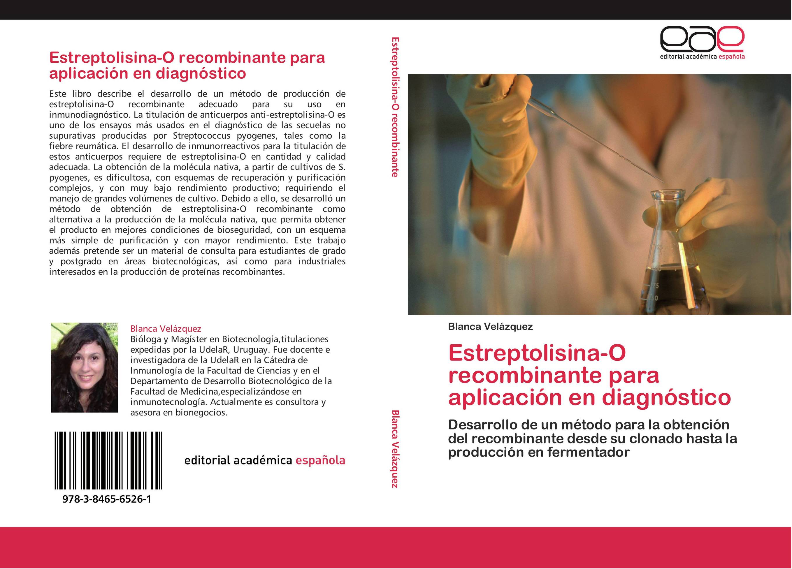 Estreptolisina-O recombinante para aplicación en diagnóstico