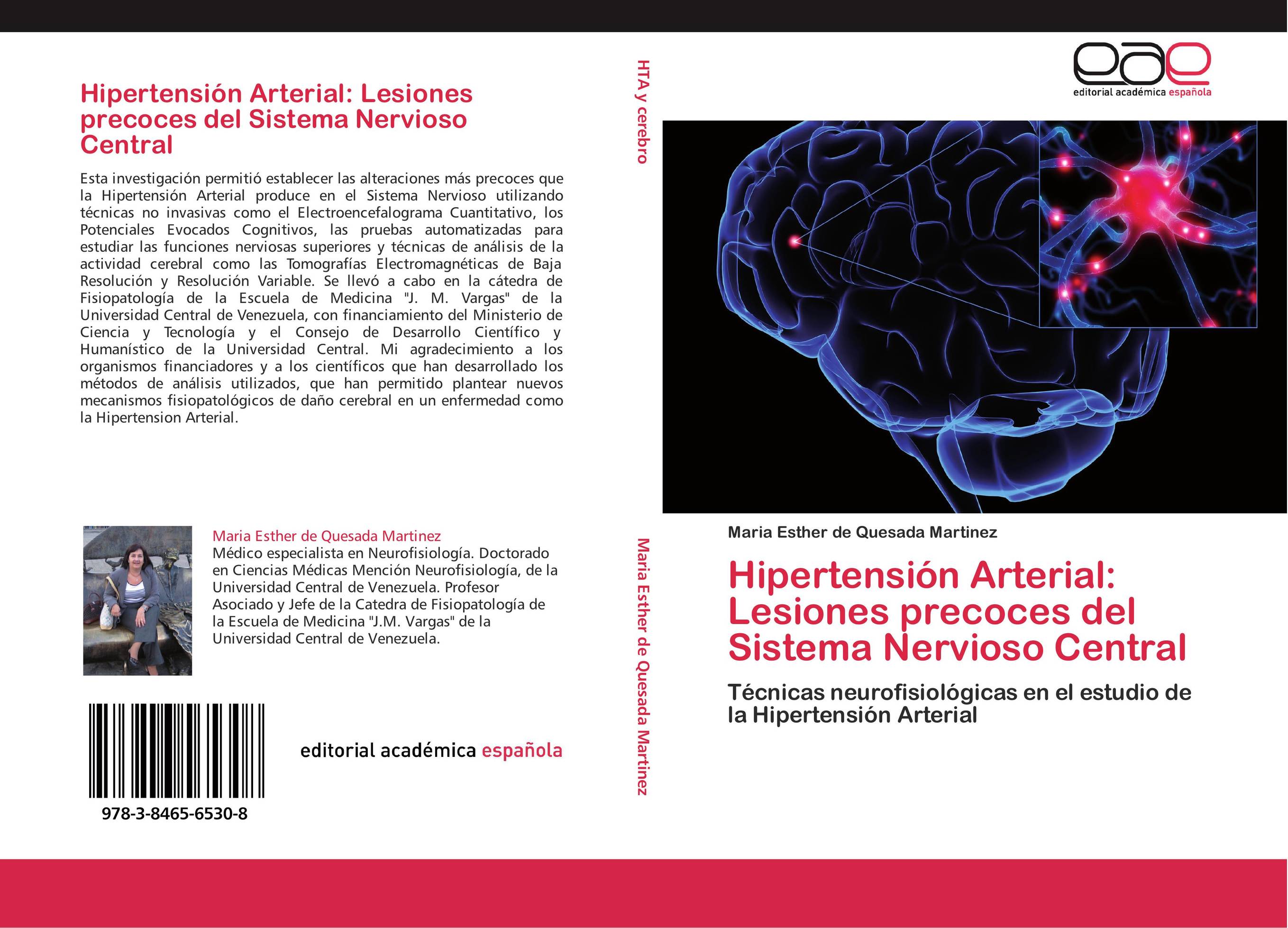 Hipertensión Arterial: Lesiones precoces del Sistema Nervioso Central