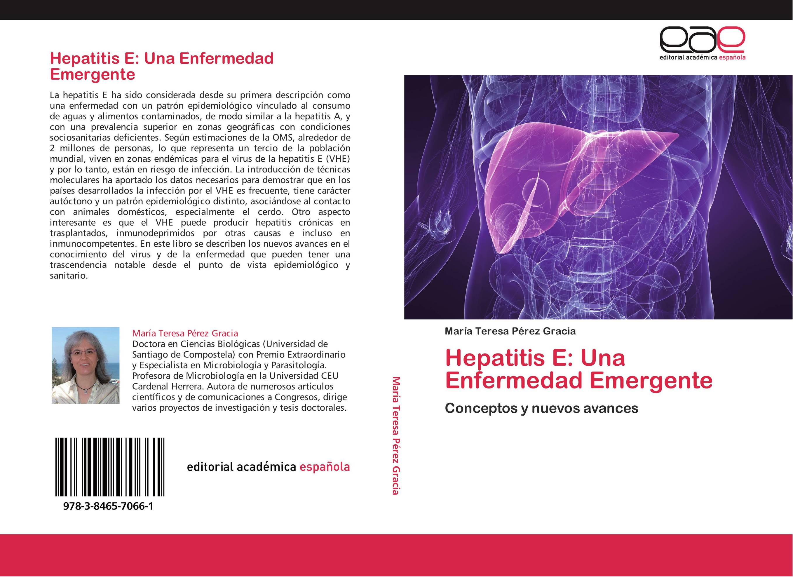 Hepatitis E: Una Enfermedad Emergente