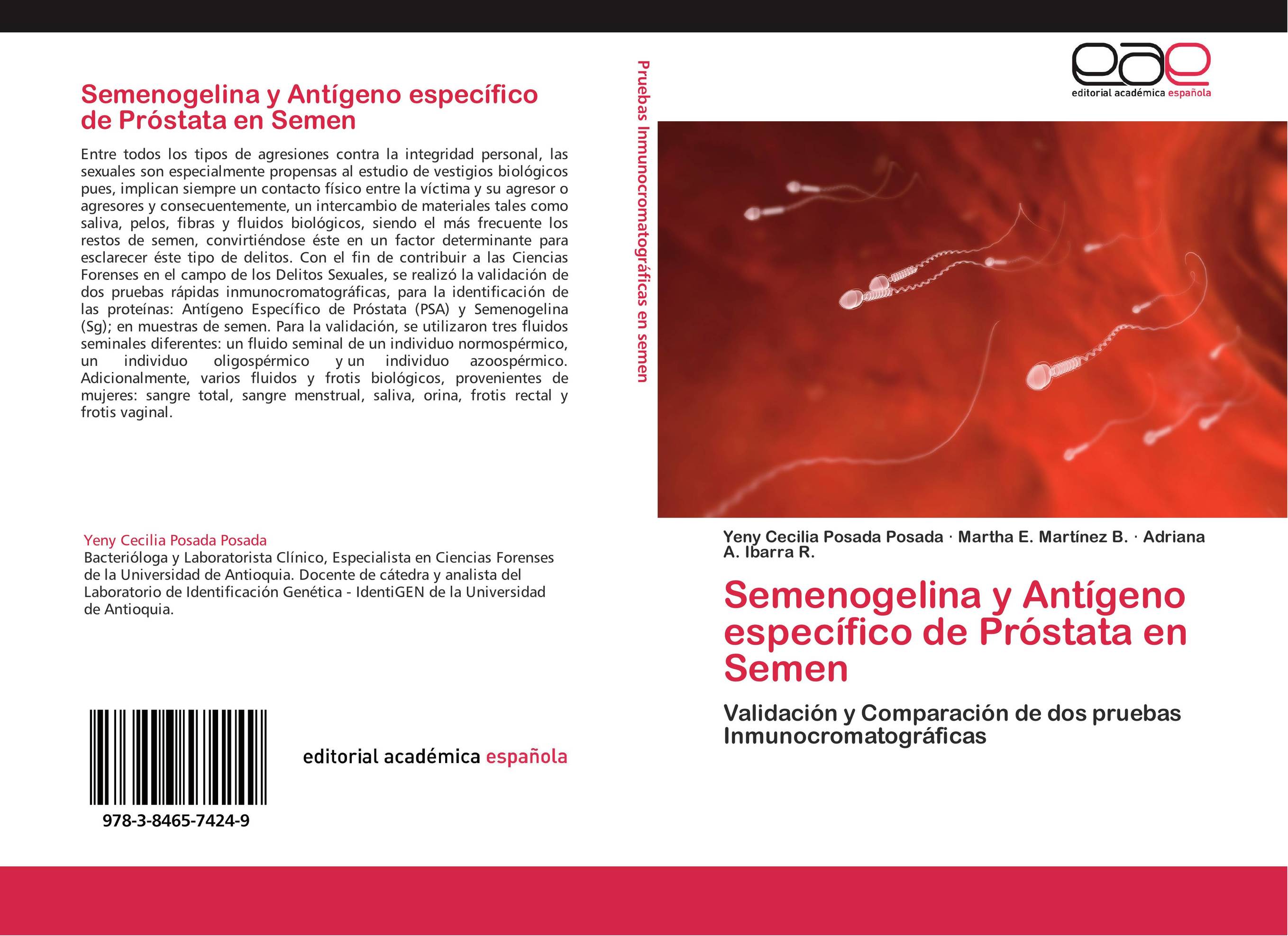 Semenogelina y Antígeno específico de Próstata en Semen