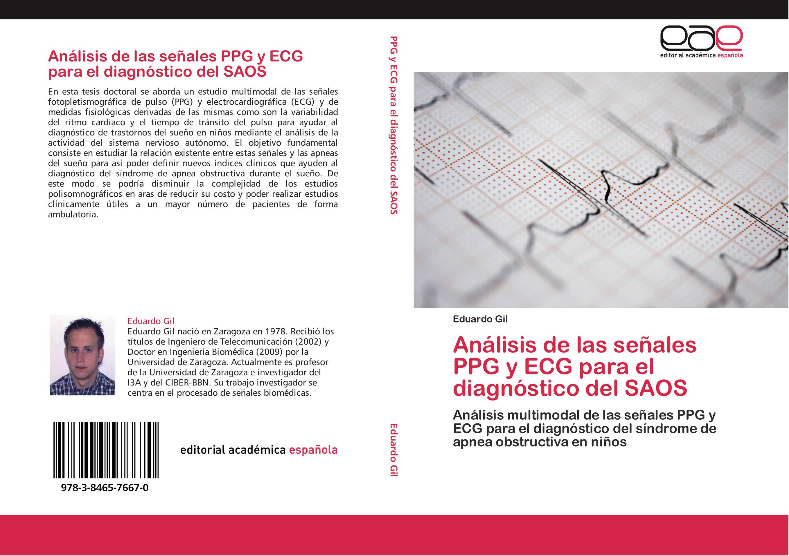 Análisis de las señales PPG y ECG para el diagnóstico del SAOS