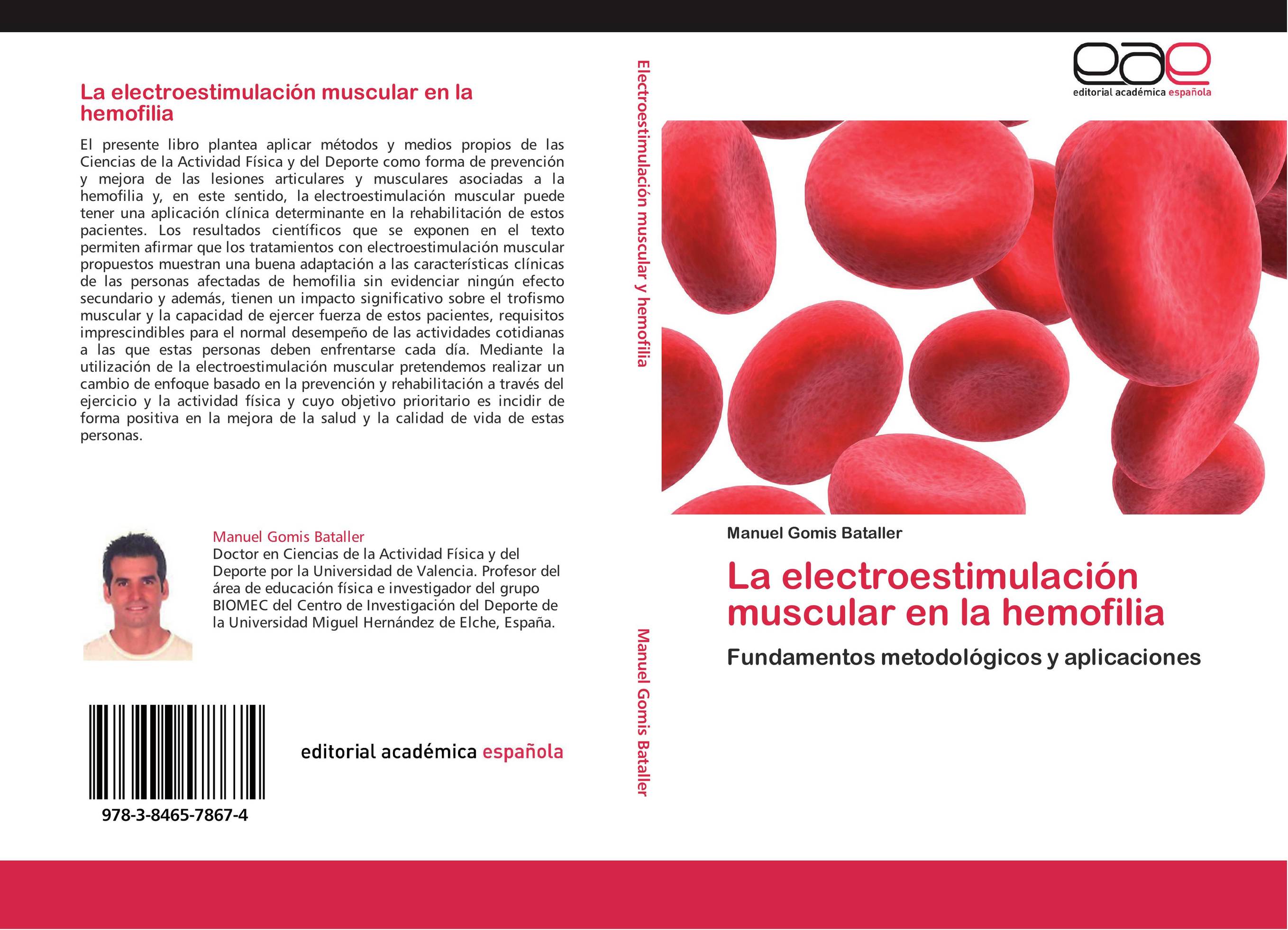 La electroestimulación muscular en la hemofilia
