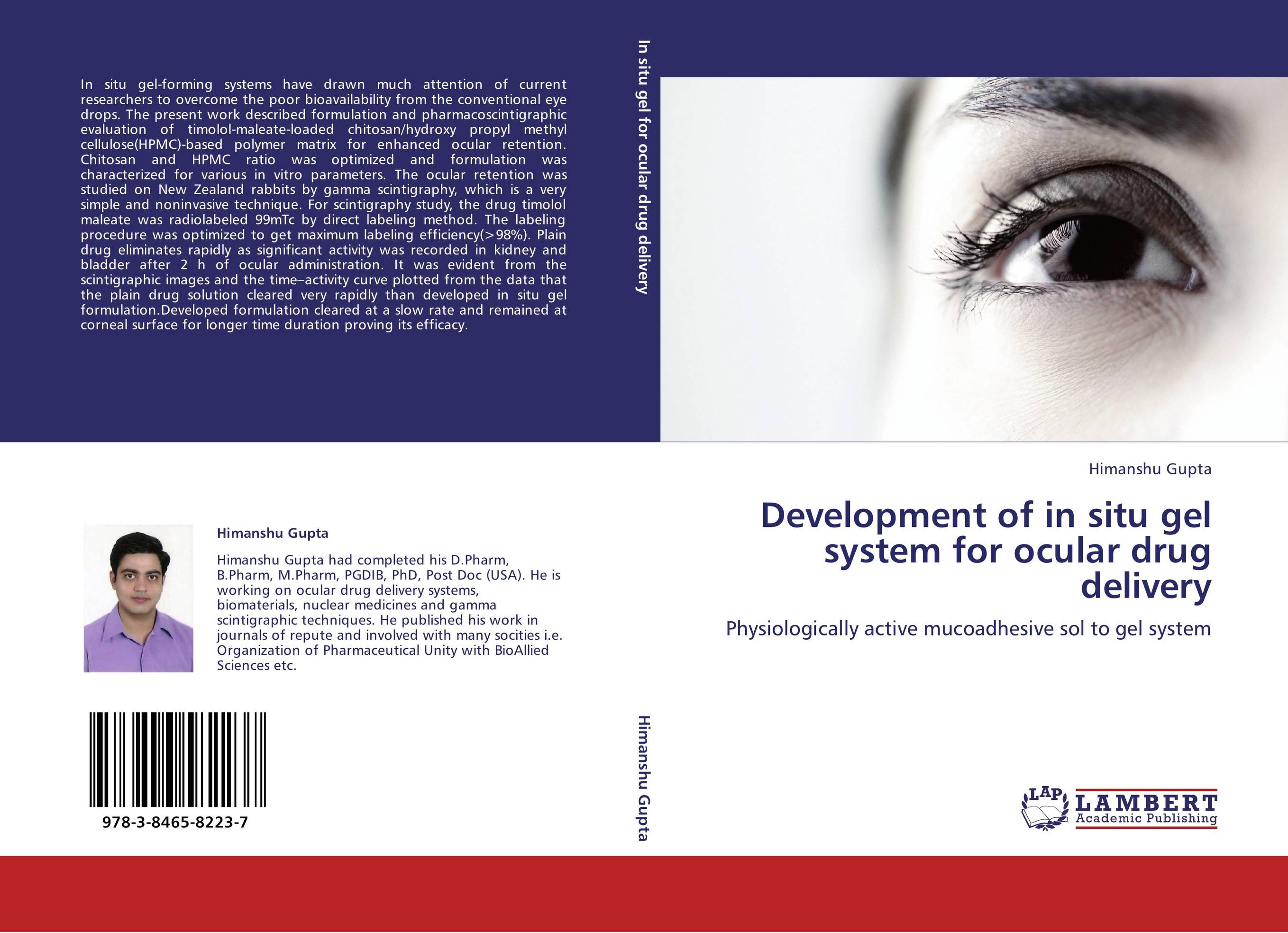 Development of in situ gel system for ocular drug delivery. Physiologically active mucoadhesive sol to gel system.