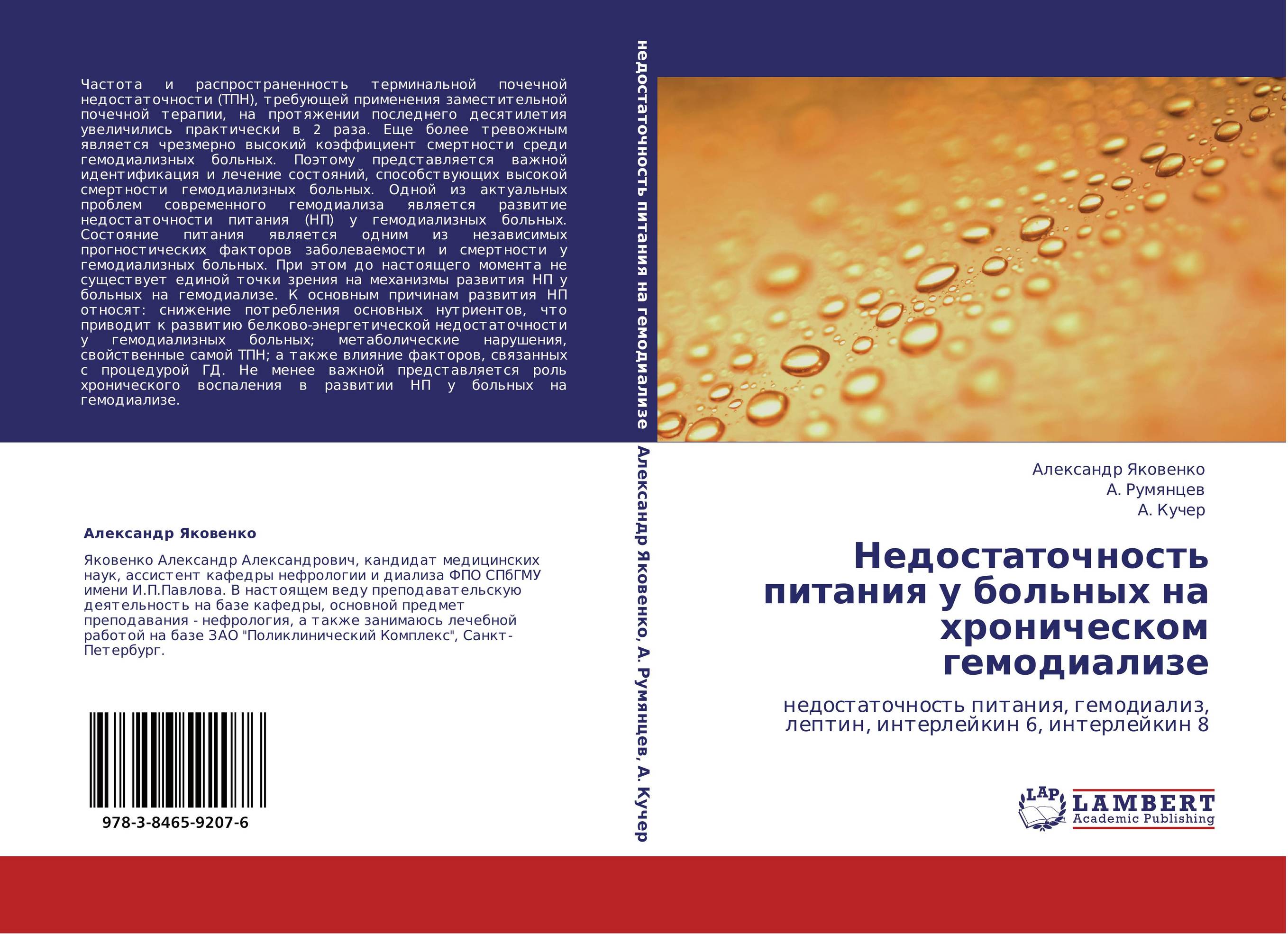 Недостаточность питания у больных на хроническом гемодиализе. Недостаточность питания, гемодиализ, лептин, интерлейкин 6, интерлейкин 8.