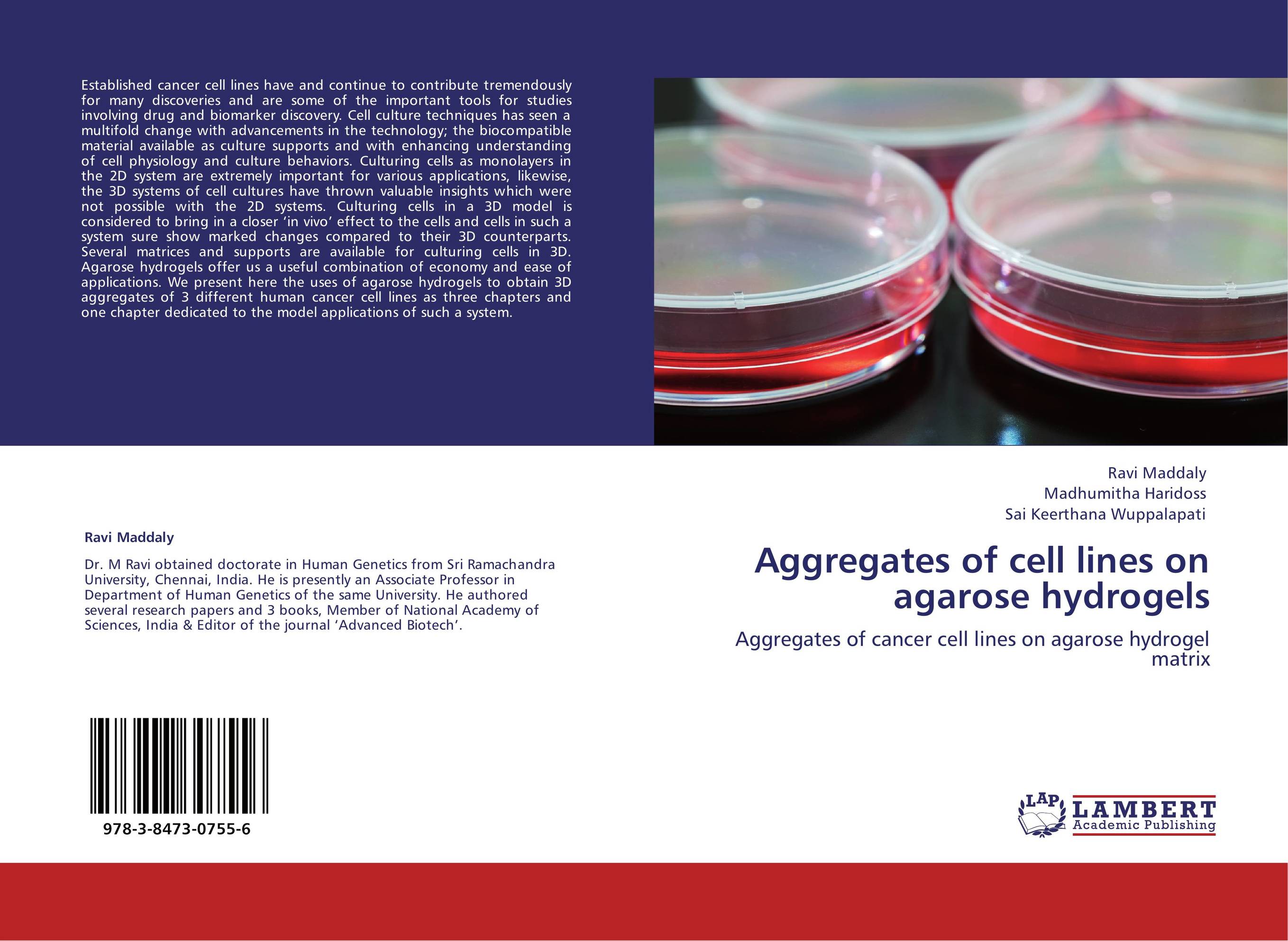 Aggregates of cell lines on agarose hydrogels. Aggregates of cancer cell lines on agarose hydrogel matrix.