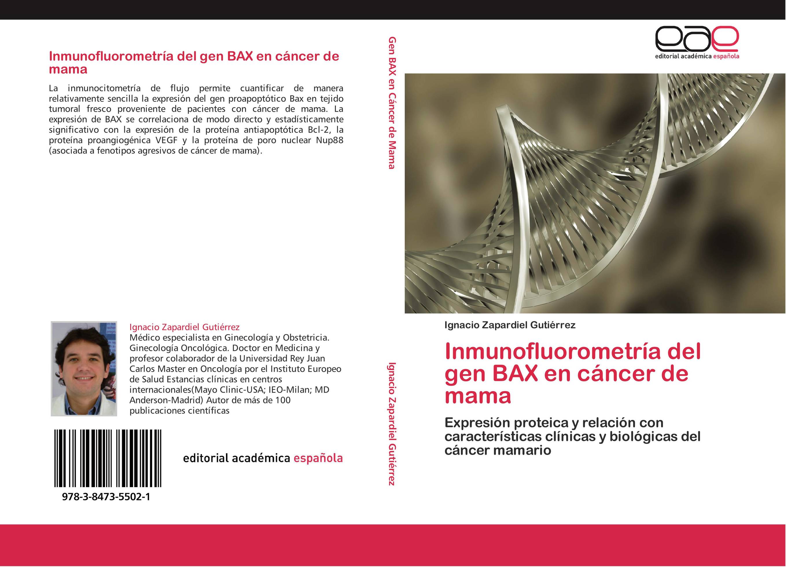 Inmunofluorometría del gen BAX en cáncer de mama